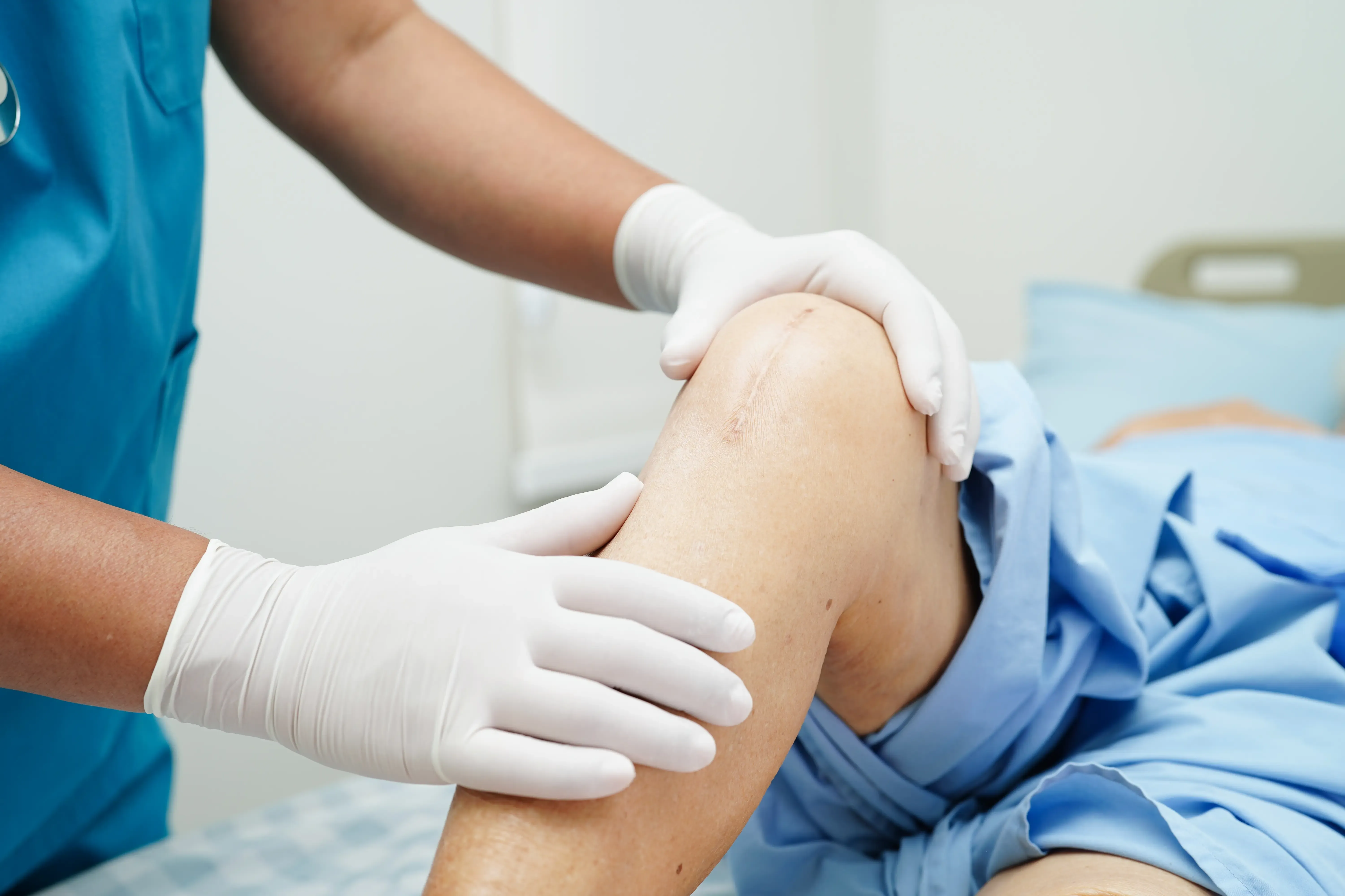 Before and after knee replacement results at Emerald Coast Ortho Fort Walton Beach