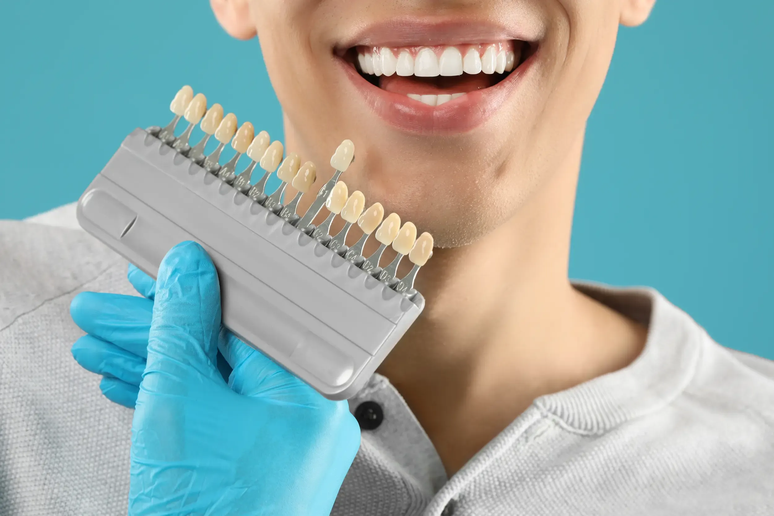 Is Teeth Whitening Safe for You? Lake Mary's Experts Weigh In