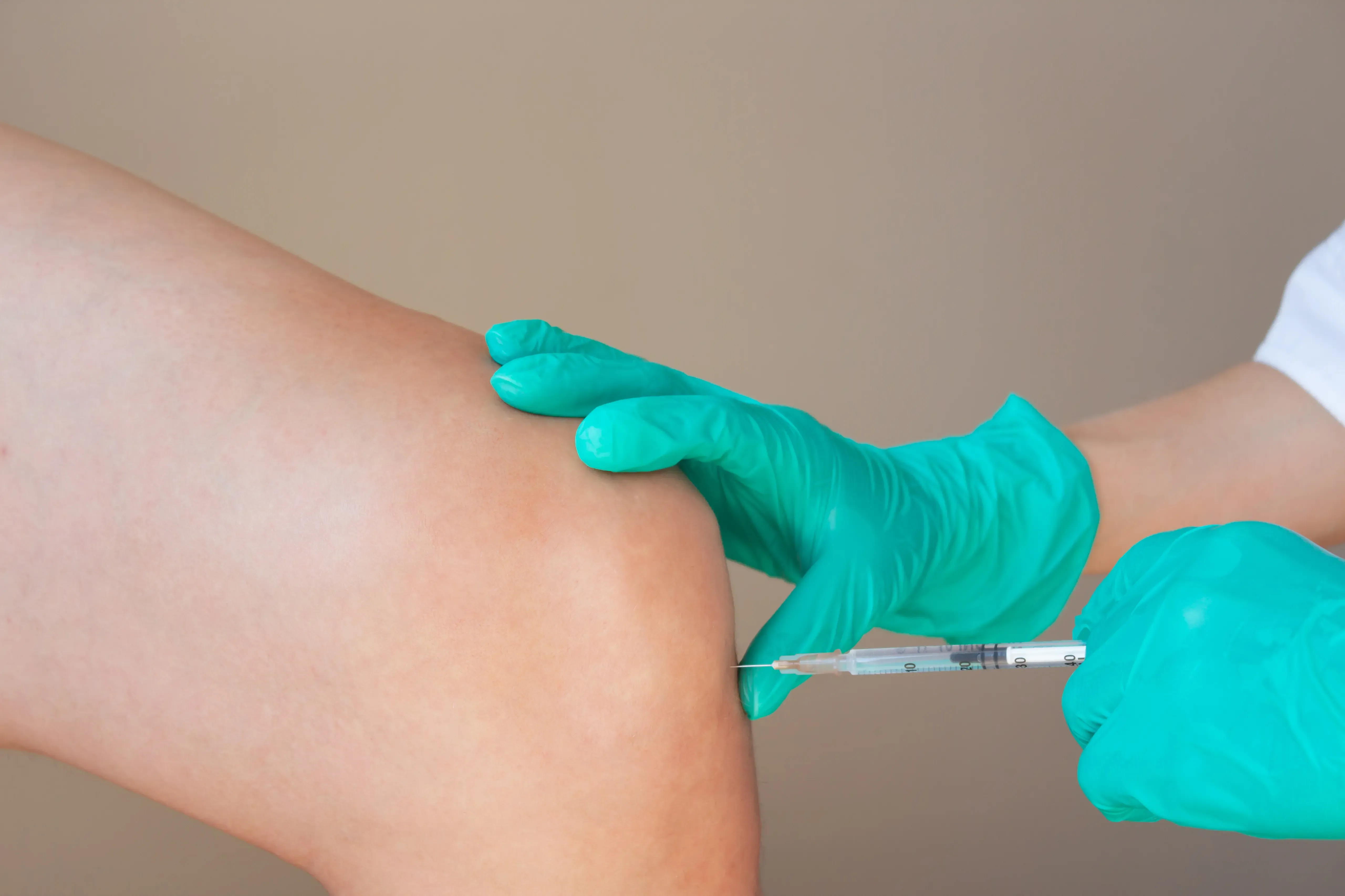 Before and after comparison showing improved knee joint mobility with viscosupplementation