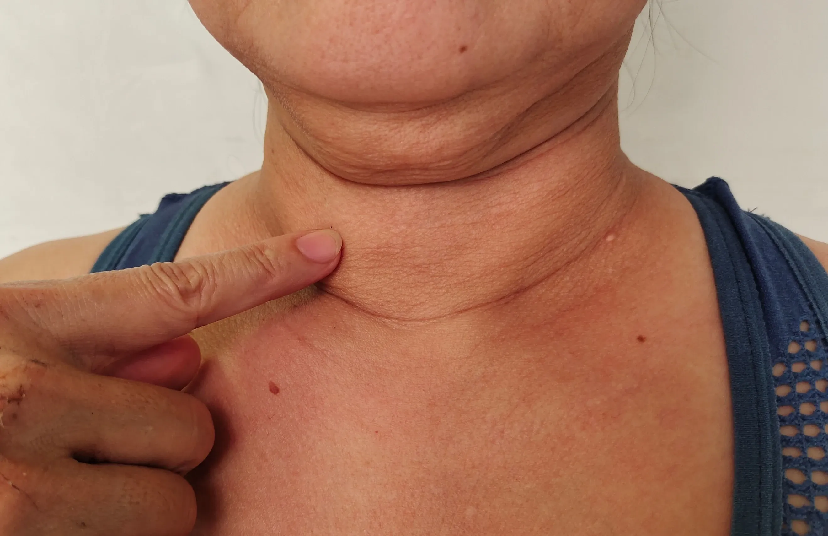 Person examining jawline at Dental World Longwood FL