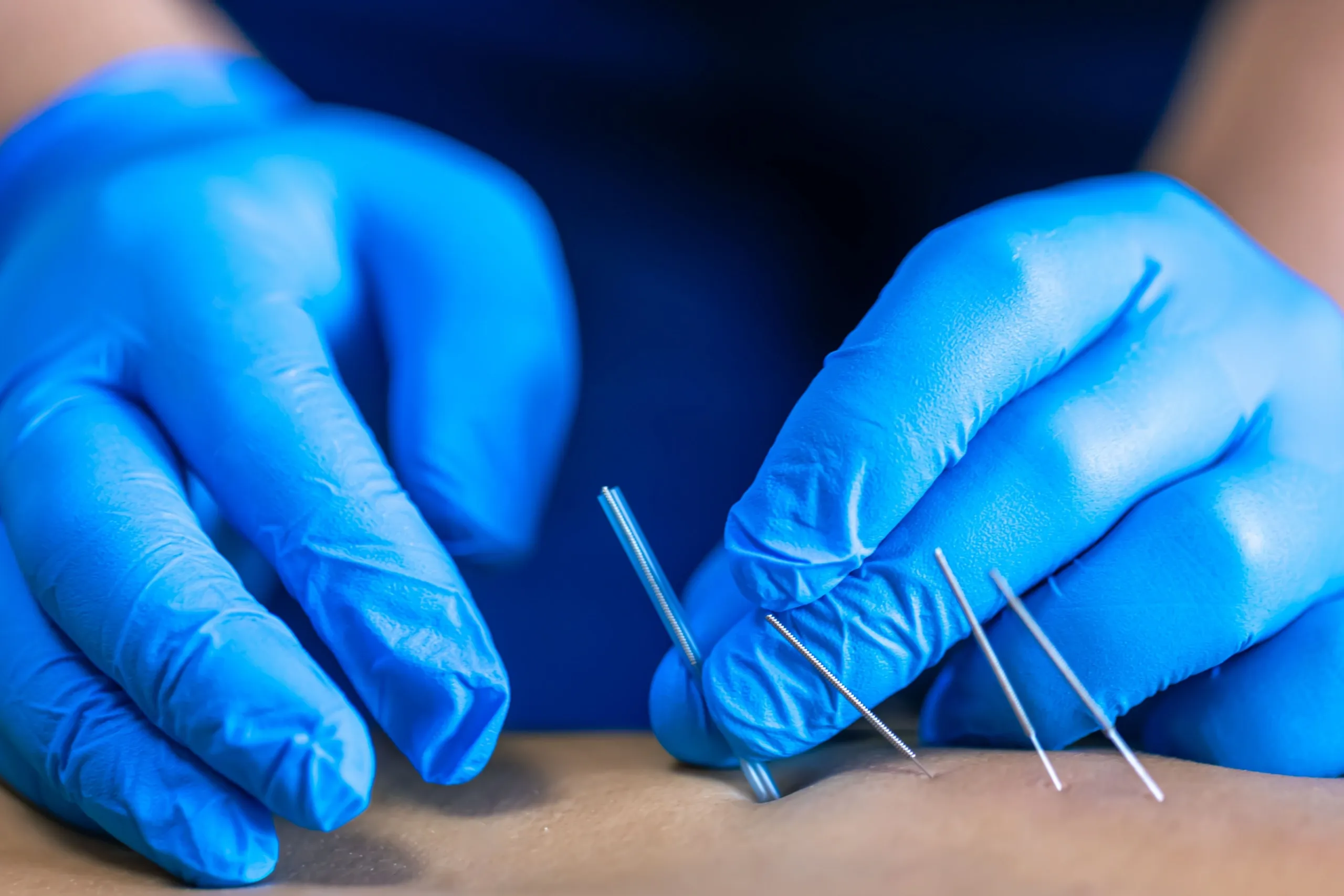 Confident patient portrait after dry needling at Roots Chiropractic Alma