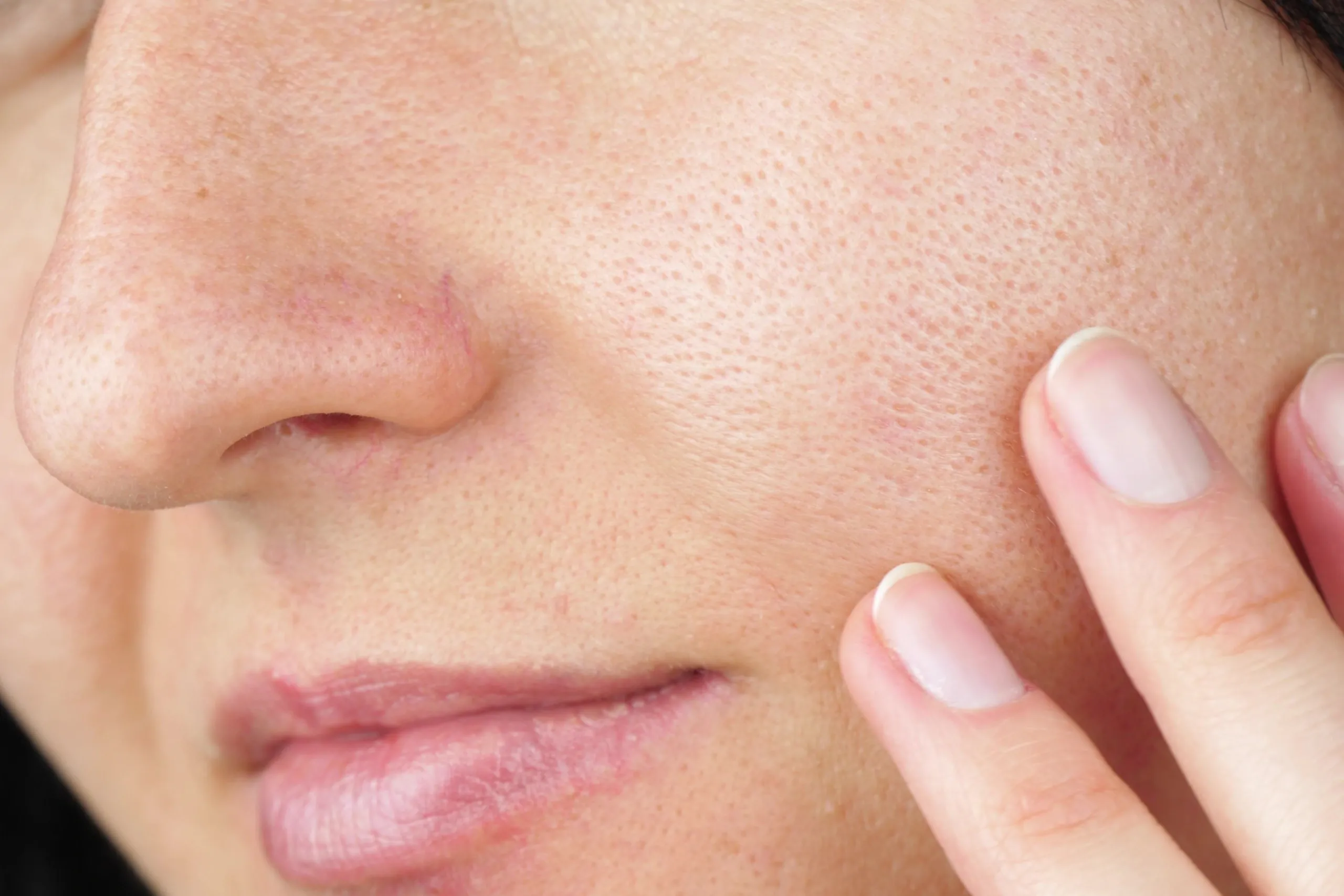 Woman examining her dull uneven skin tone at Eternal Wellness Medical Spa Traverse City