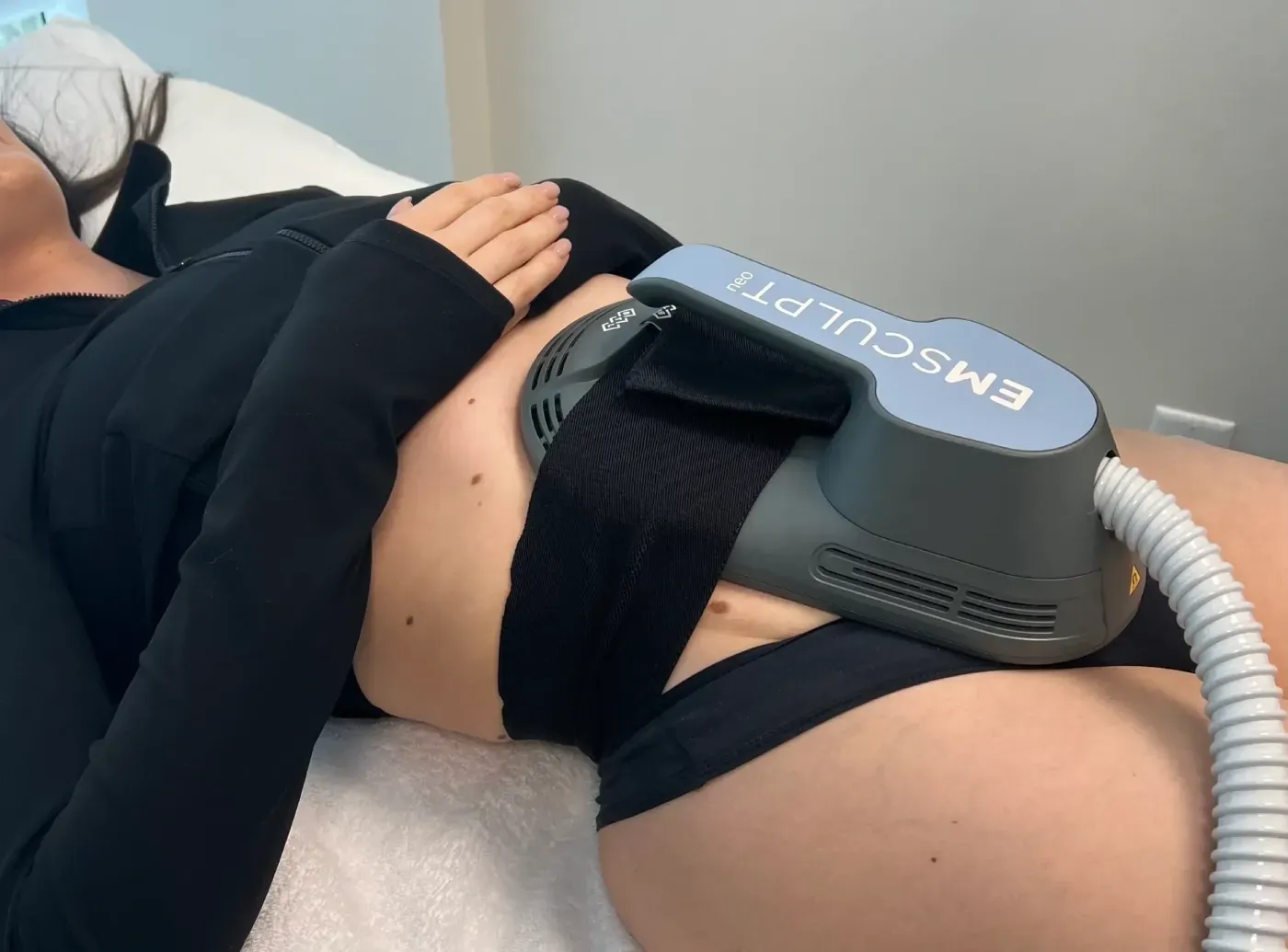 Before and after Emsculpt results showing improved abdominal tone at Heritage Wellness Crescent Springs