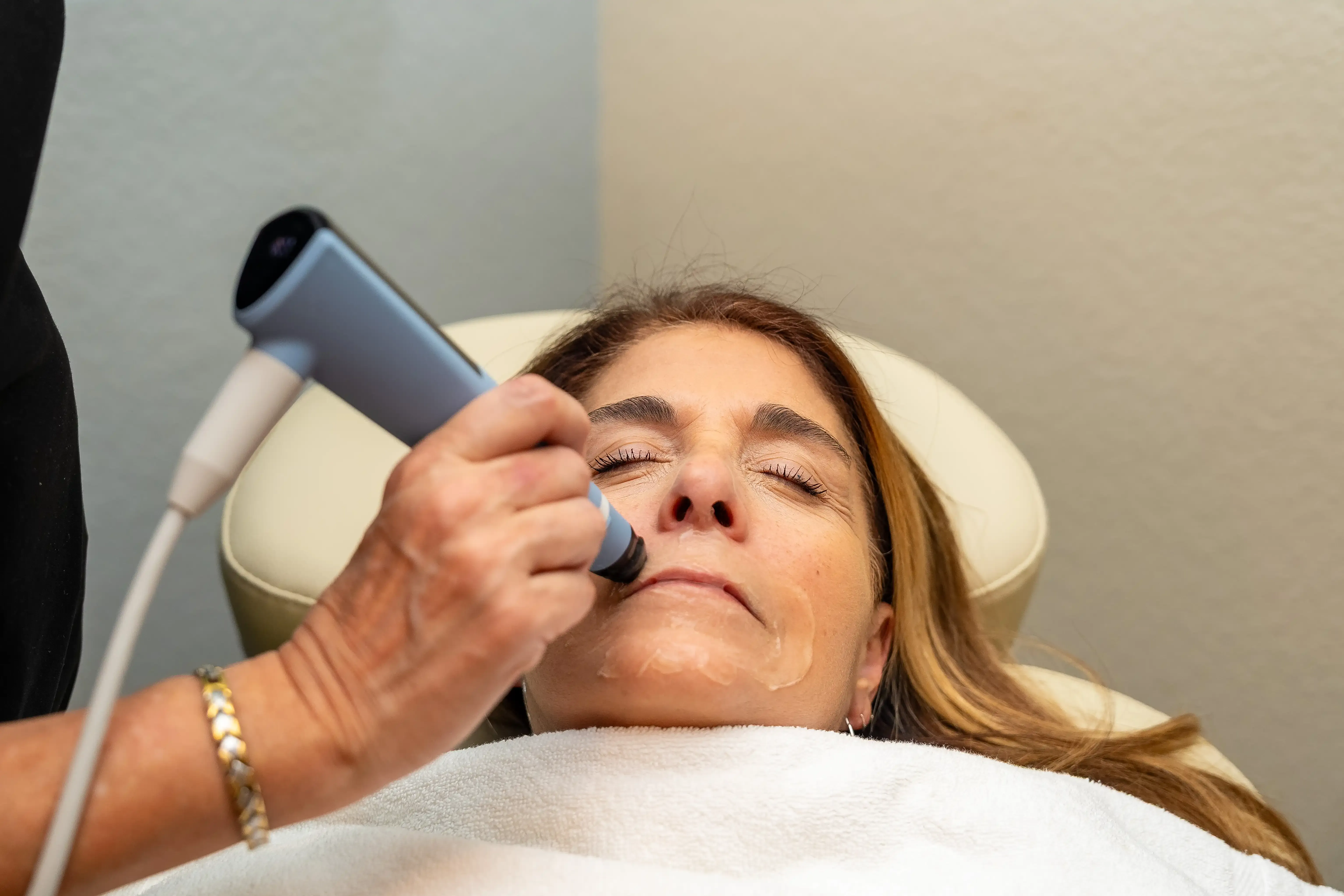 Before and after skin transformation with BTL Exion treatment at Arise Integrative Wellness