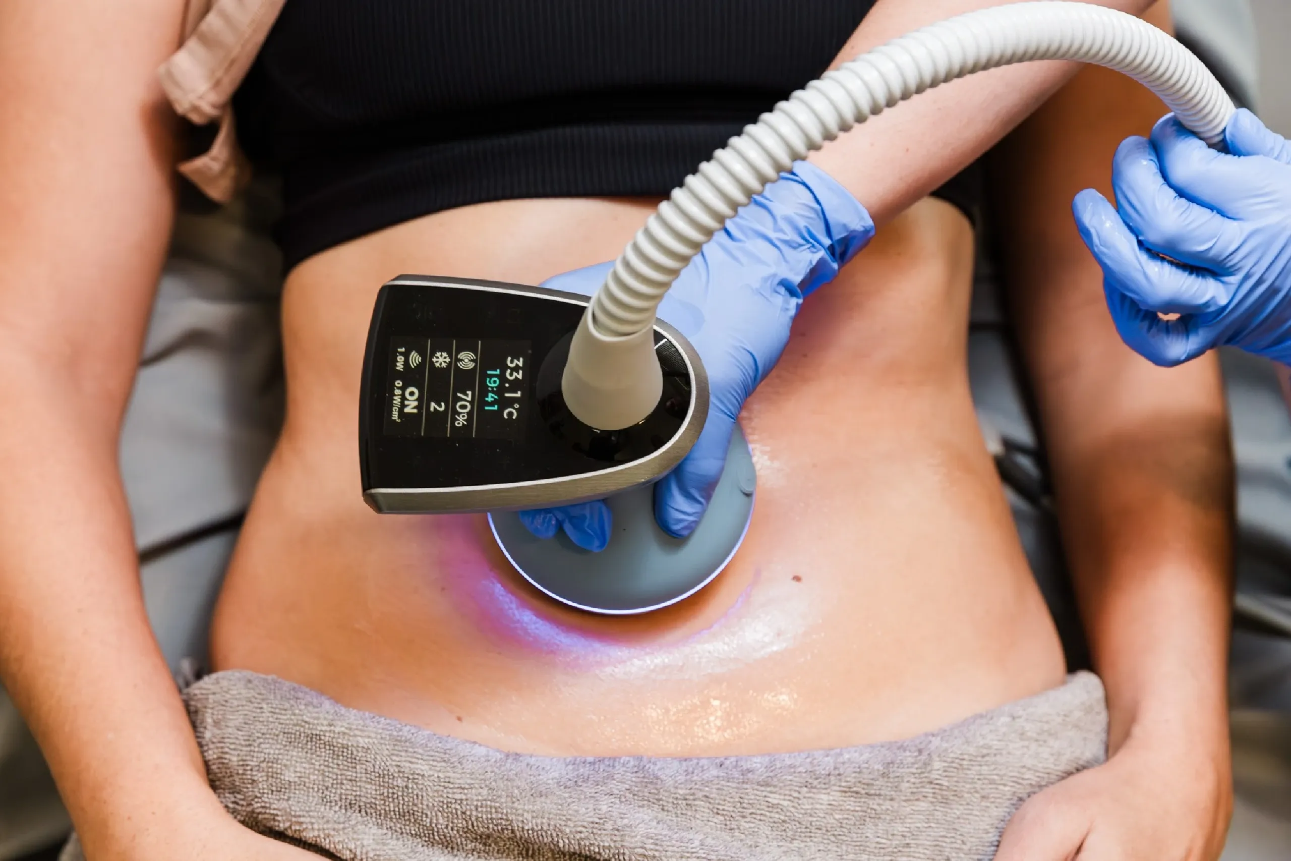Exion treatment at Mint Aesthetics & Skin in Indianapolis IN