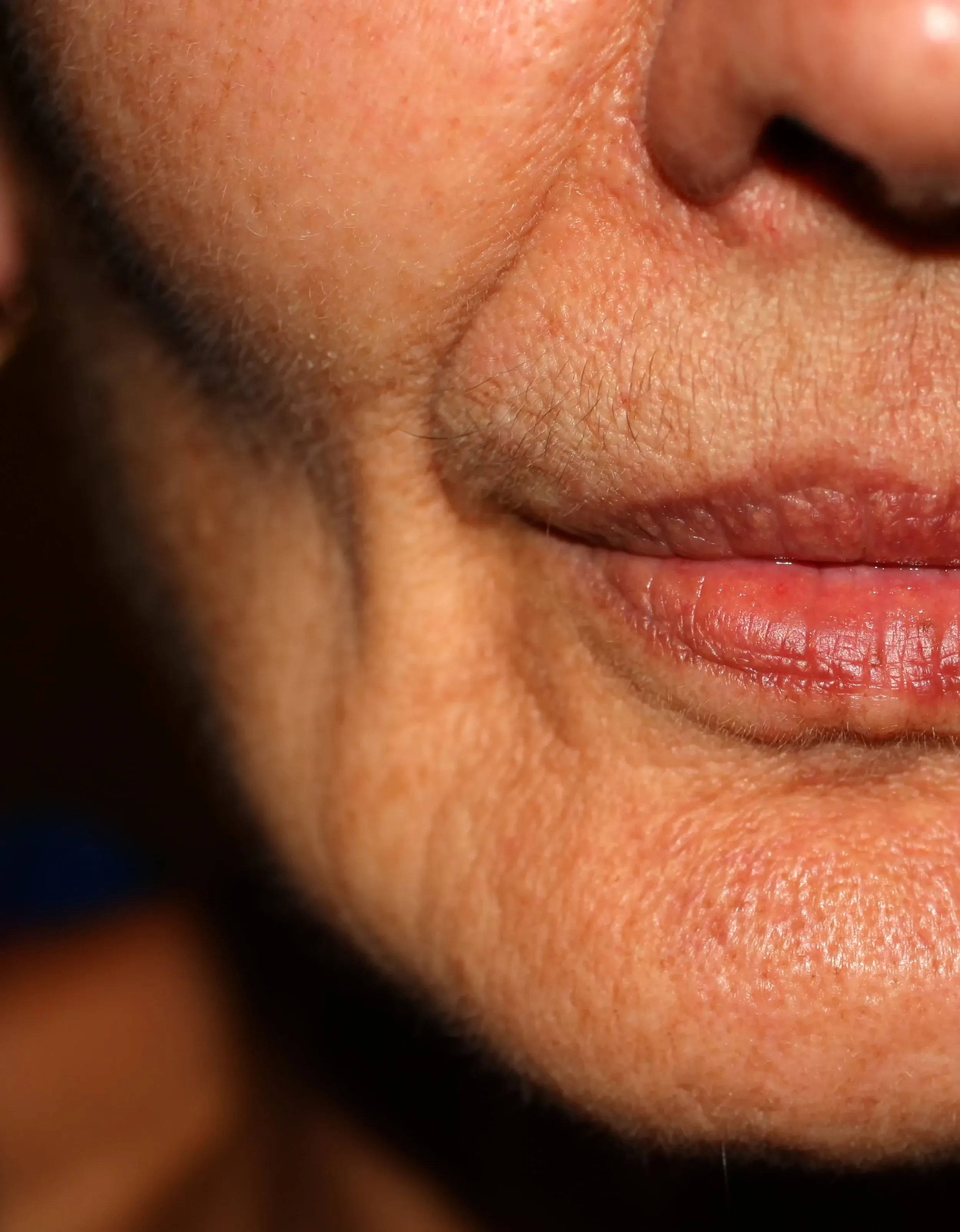 Close-up showing signs of facial volume depletion at Eternal Wellness Medical Spa