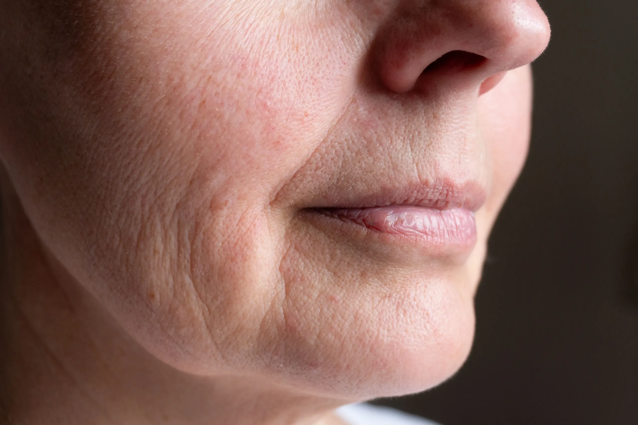 Lifestyle factors contributing to facial volume loss at Eternal Wellness Medical Spa Traverse City