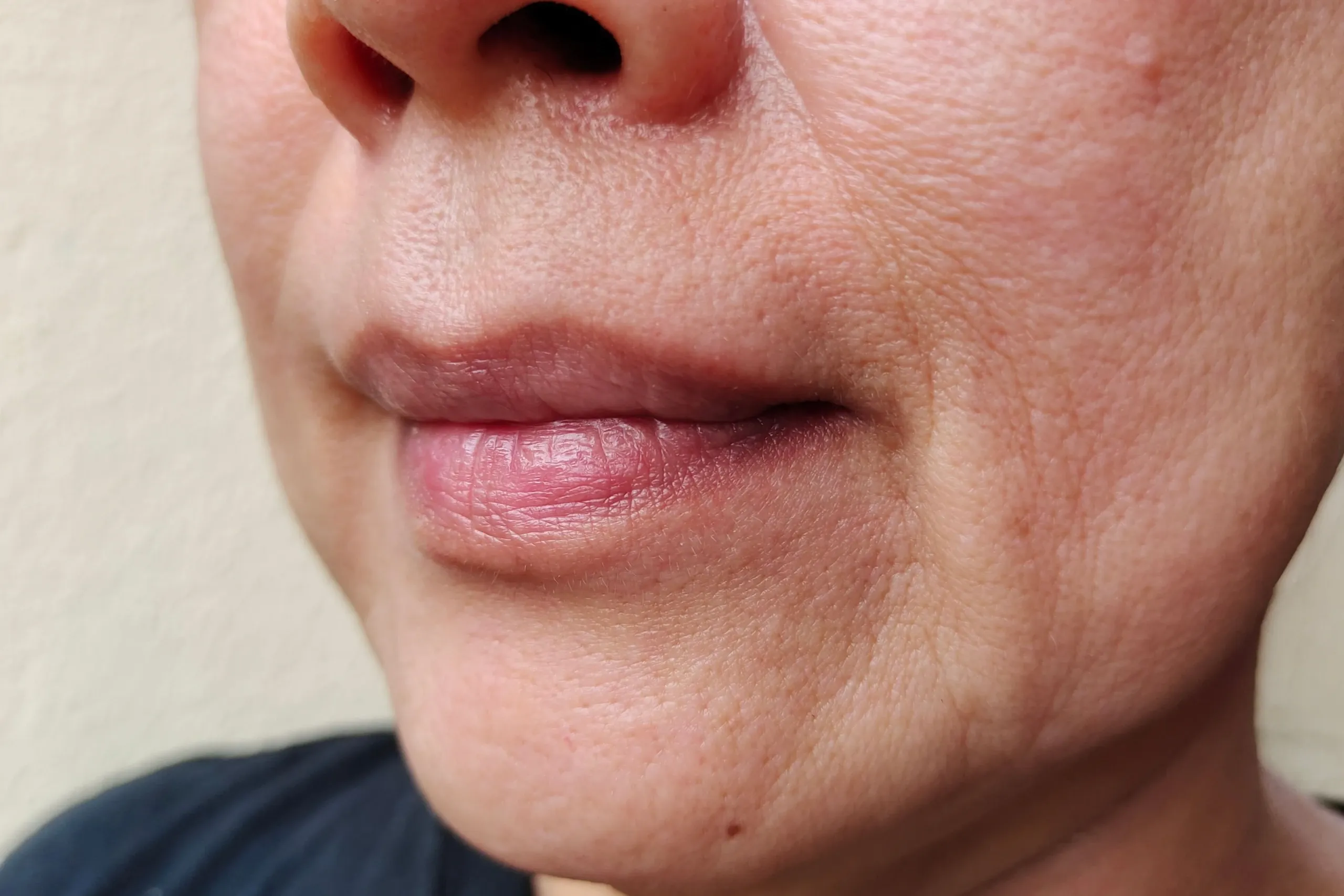 Woman examining facial volume loss in mirror at Eternal Wellness Medical Spa Traverse City