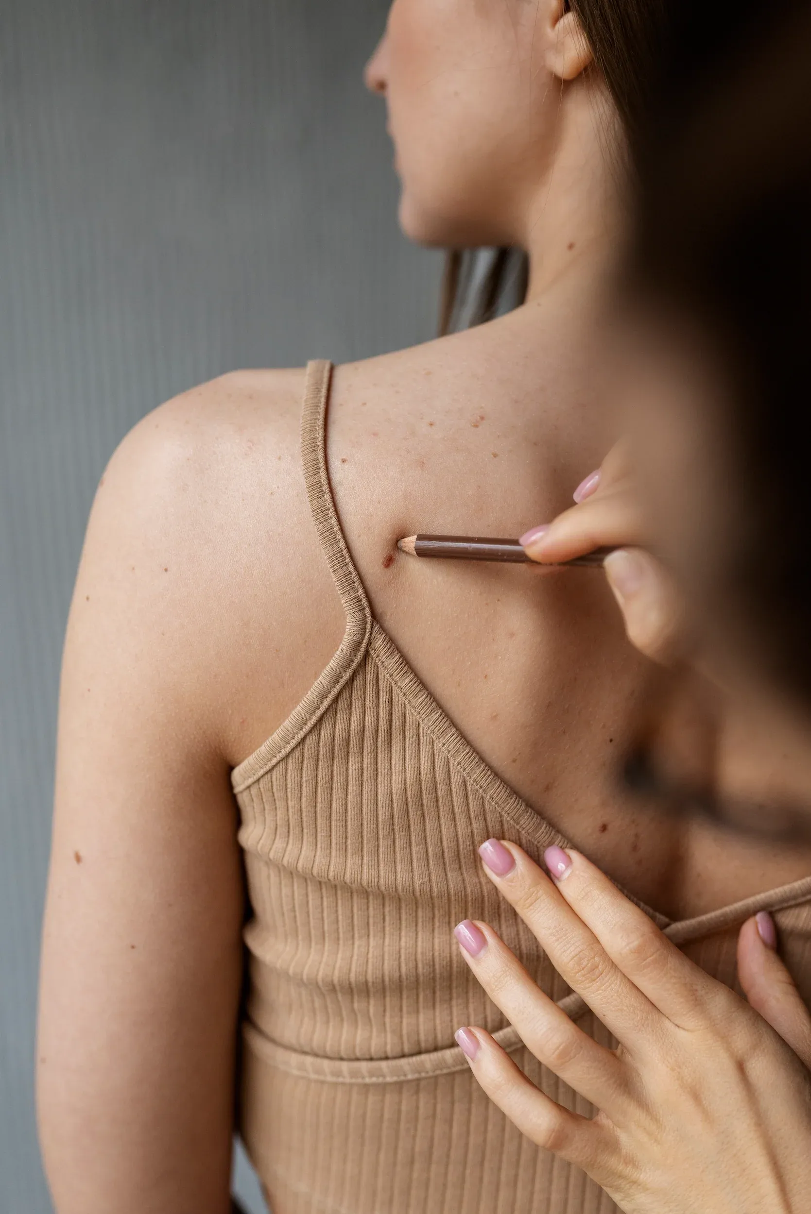 patient reviewing wart removal options with physician Venice FL