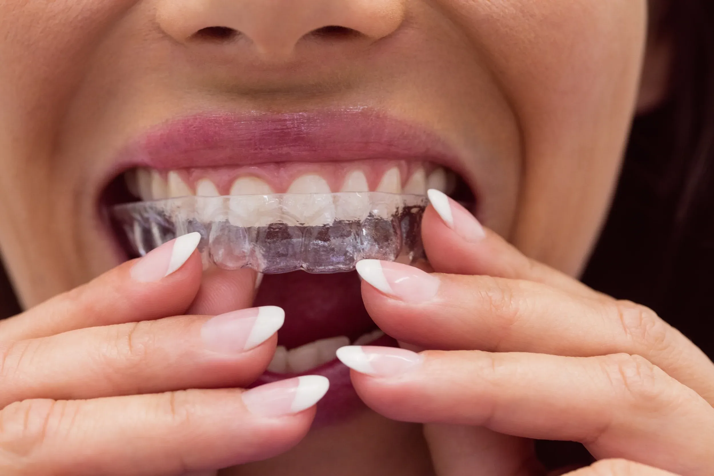 Abstract soft gradient background representing dental alignment and orthodontic care