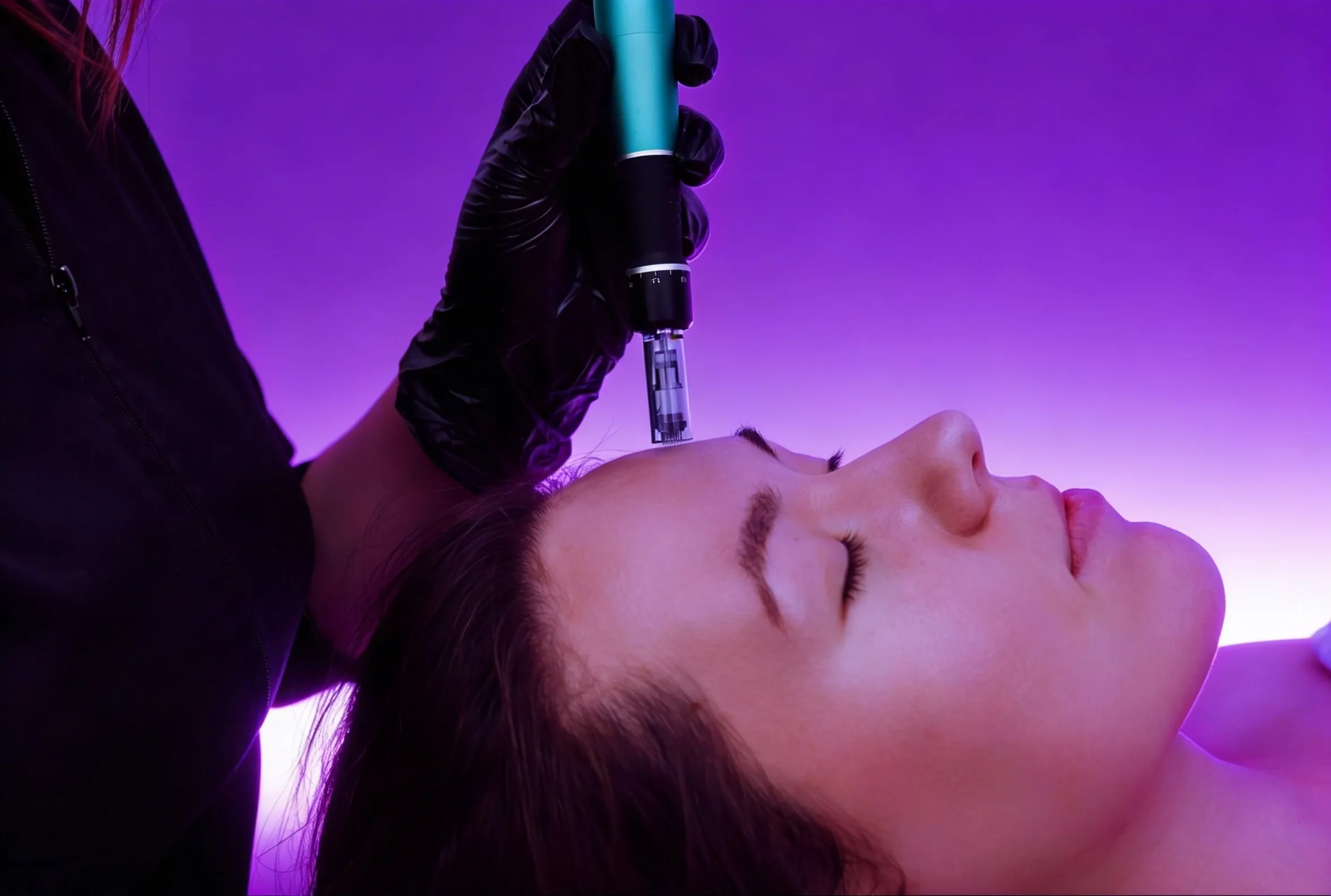 Patient receiving plasma skin treatment at RegalMed Clinic in Fort Myers, FL
