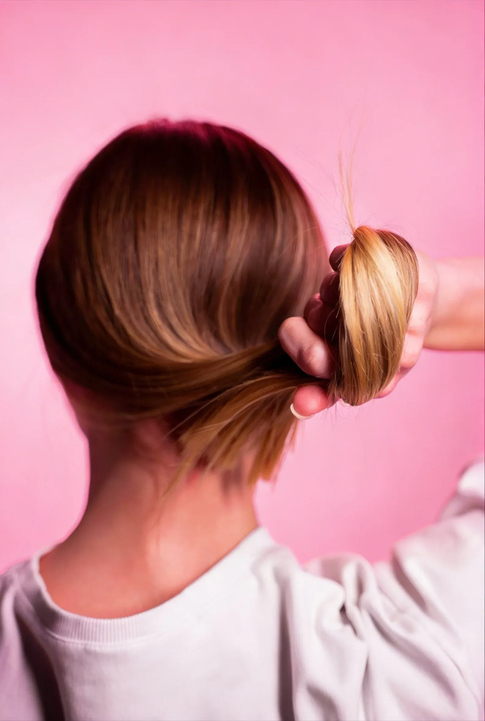 Close-up showing hair thinning patterns at RegalMed Clinic