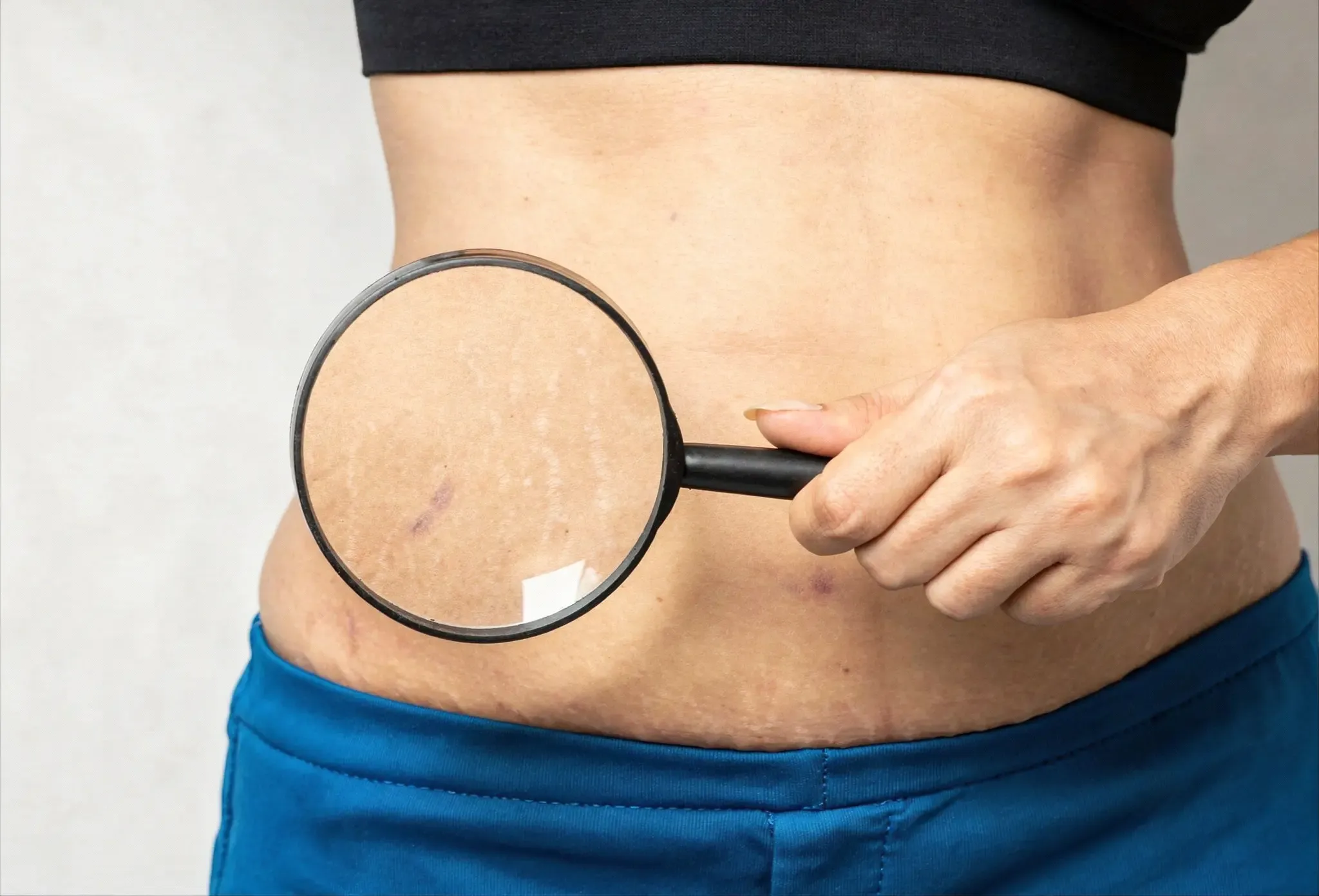 Woman with confident, smooth skin at Heritage Wellness & Med Spa Crescent Springs