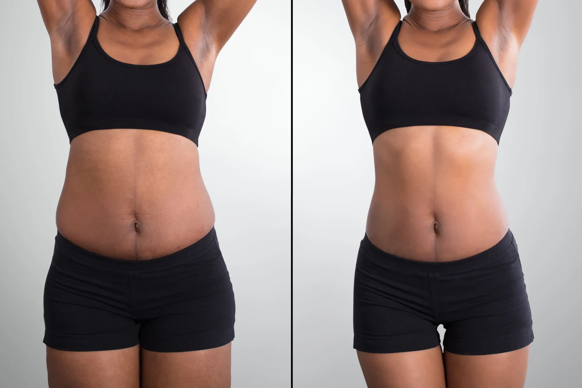Weight Loss before and after