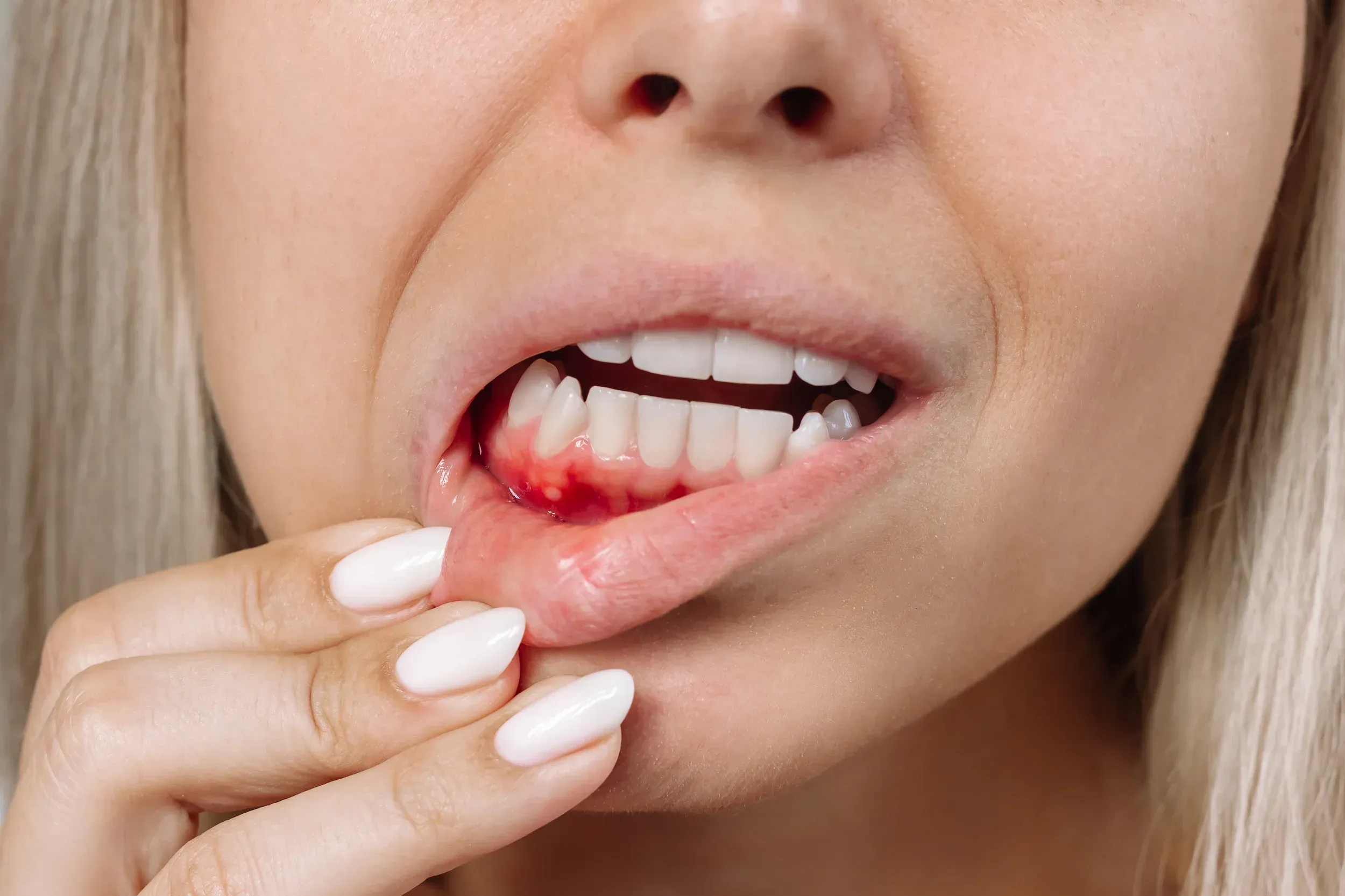 <span class="text-accent">Gum Disease Treatment</span> in Santa Rosa Beach, FL