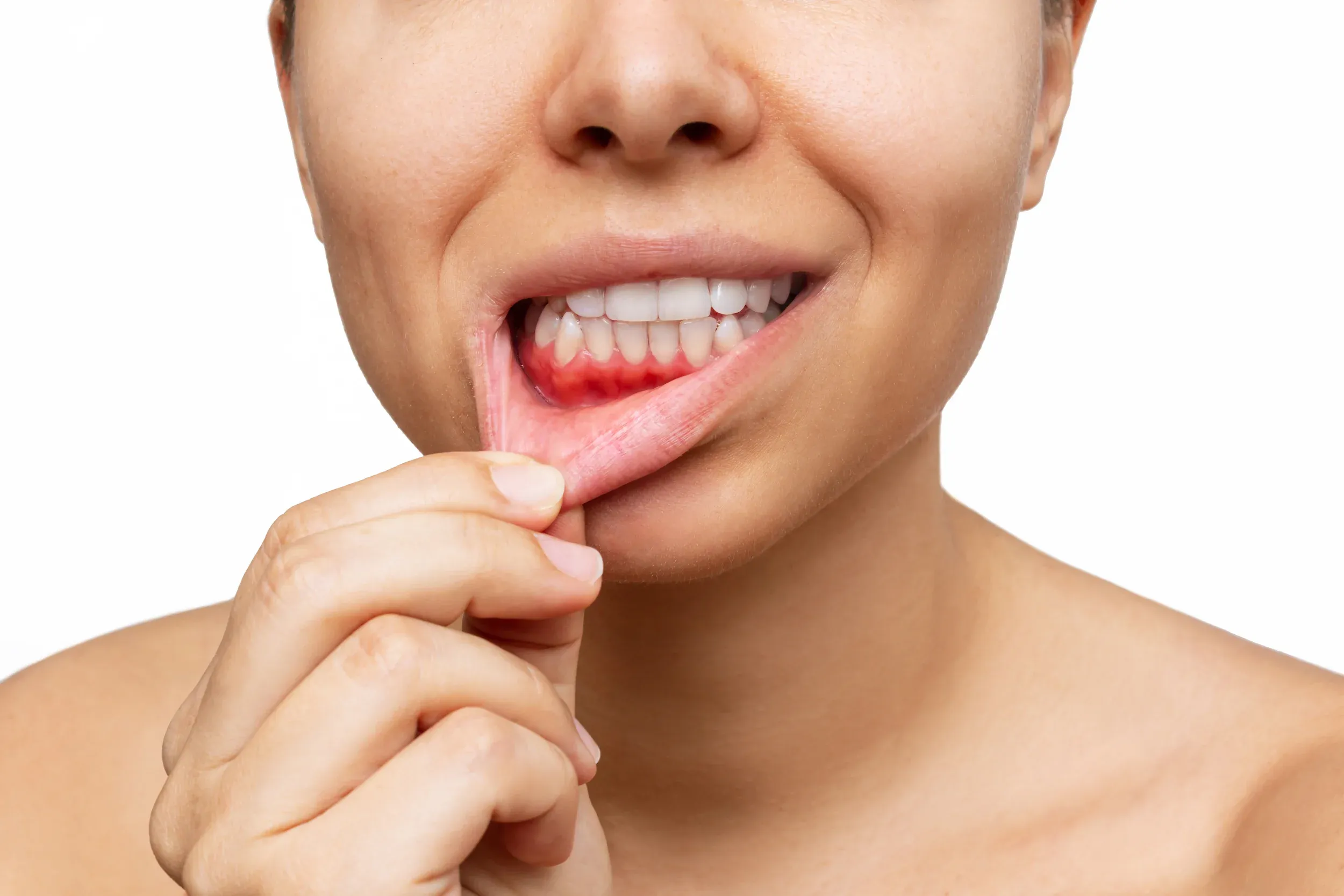 Patient receiving gum evaluation at Dental World Longwood FL