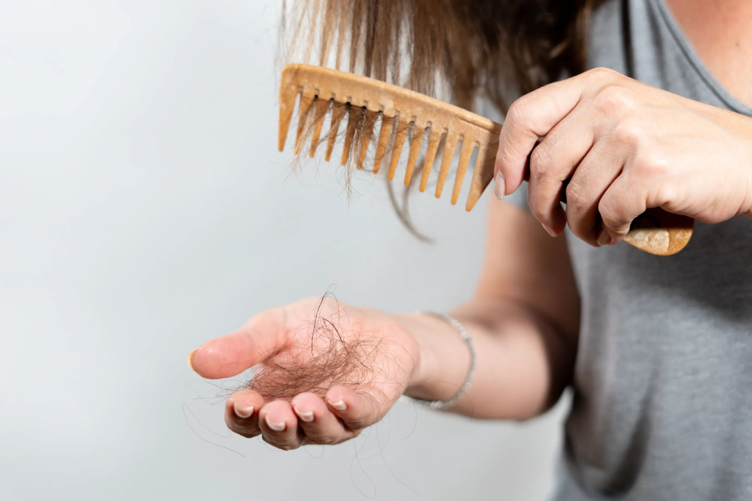 Hair Loss Prevention: Early Signs and Proactive Strategies