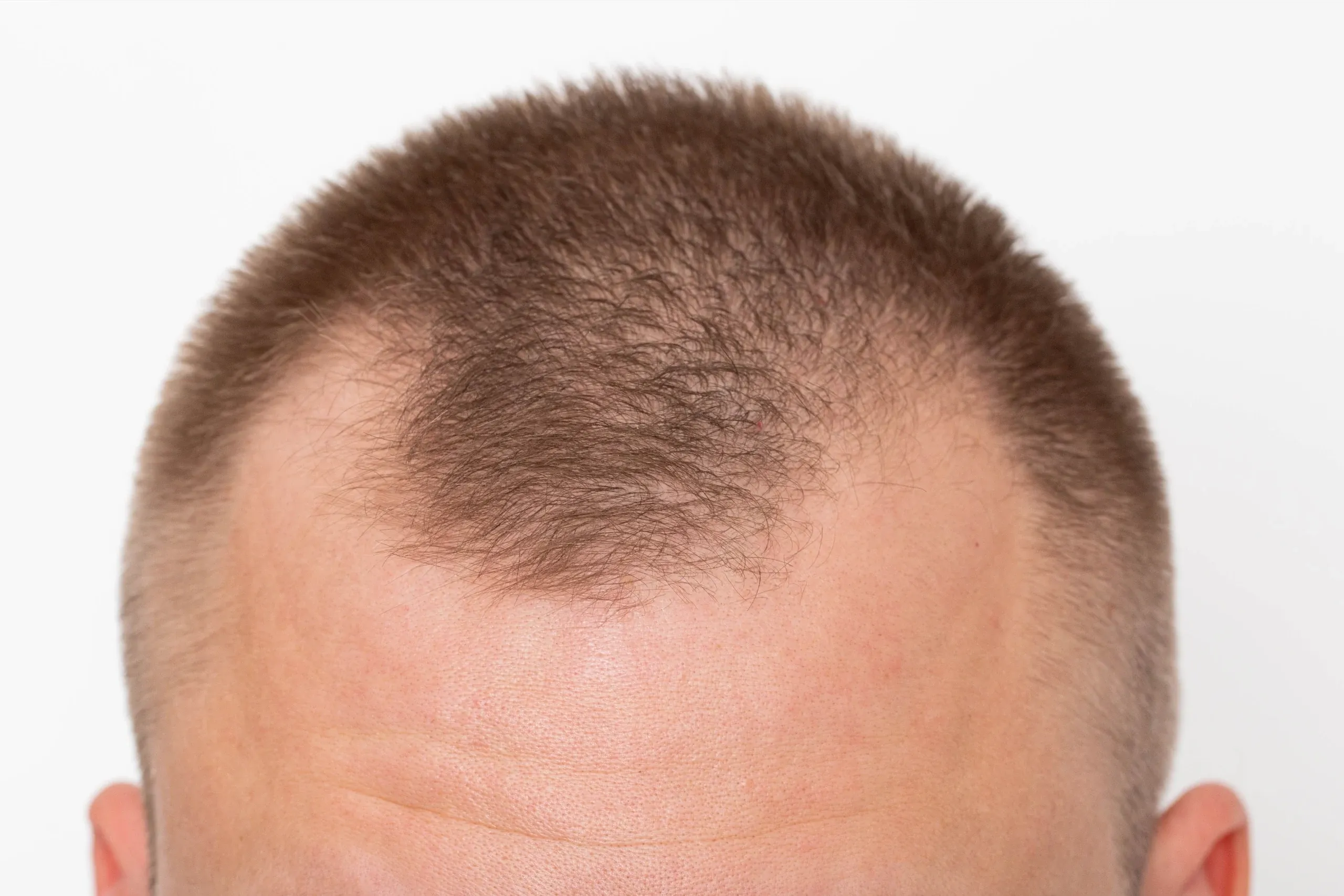 Can Your Hair Stop Growing? Let's Talk About It