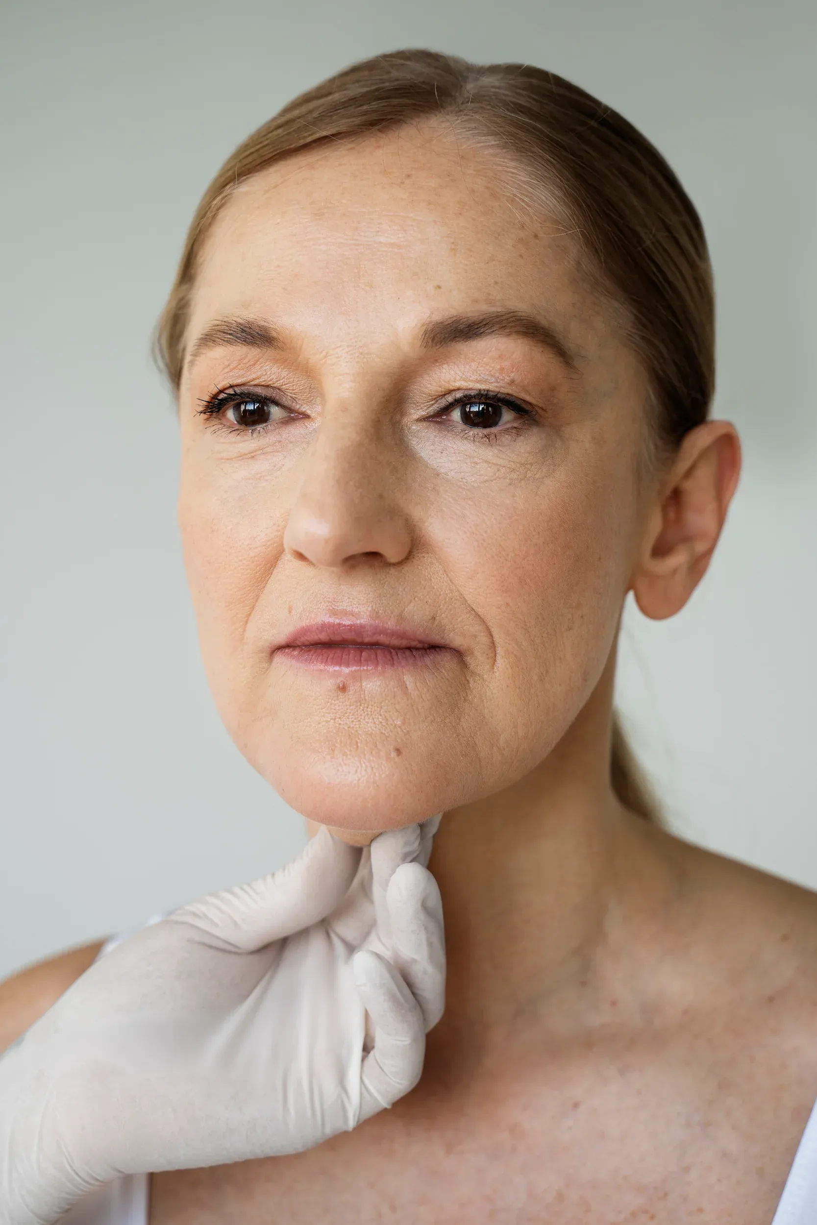 Diagram showing facial fat pad structure at Mint Aesthetics & Skin