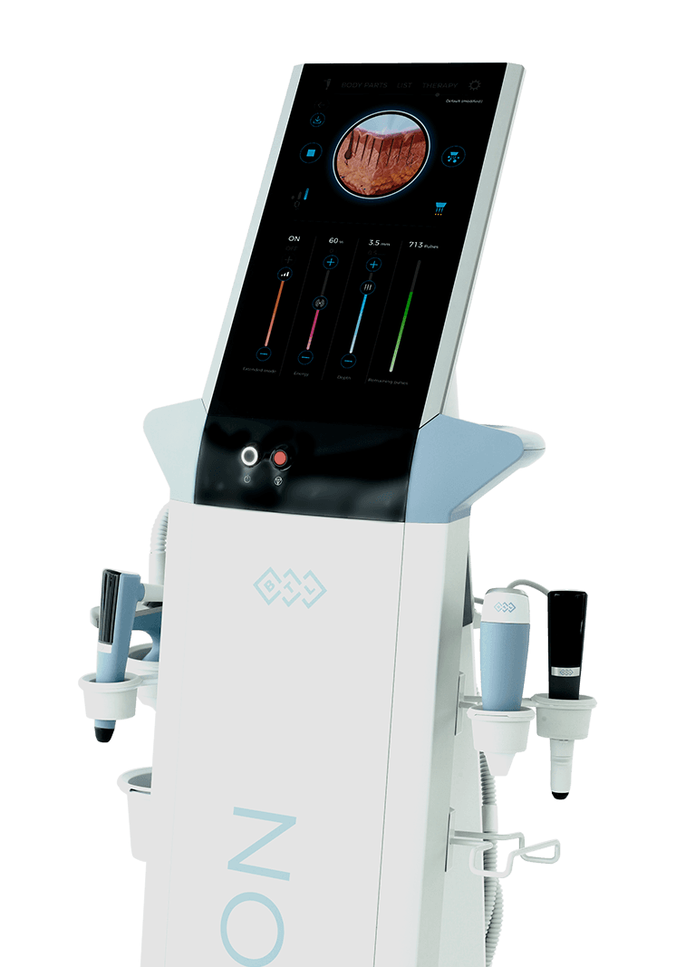 Patient consultation for Exion Clear RF at Eternal Wellness Medical Spa Traverse City