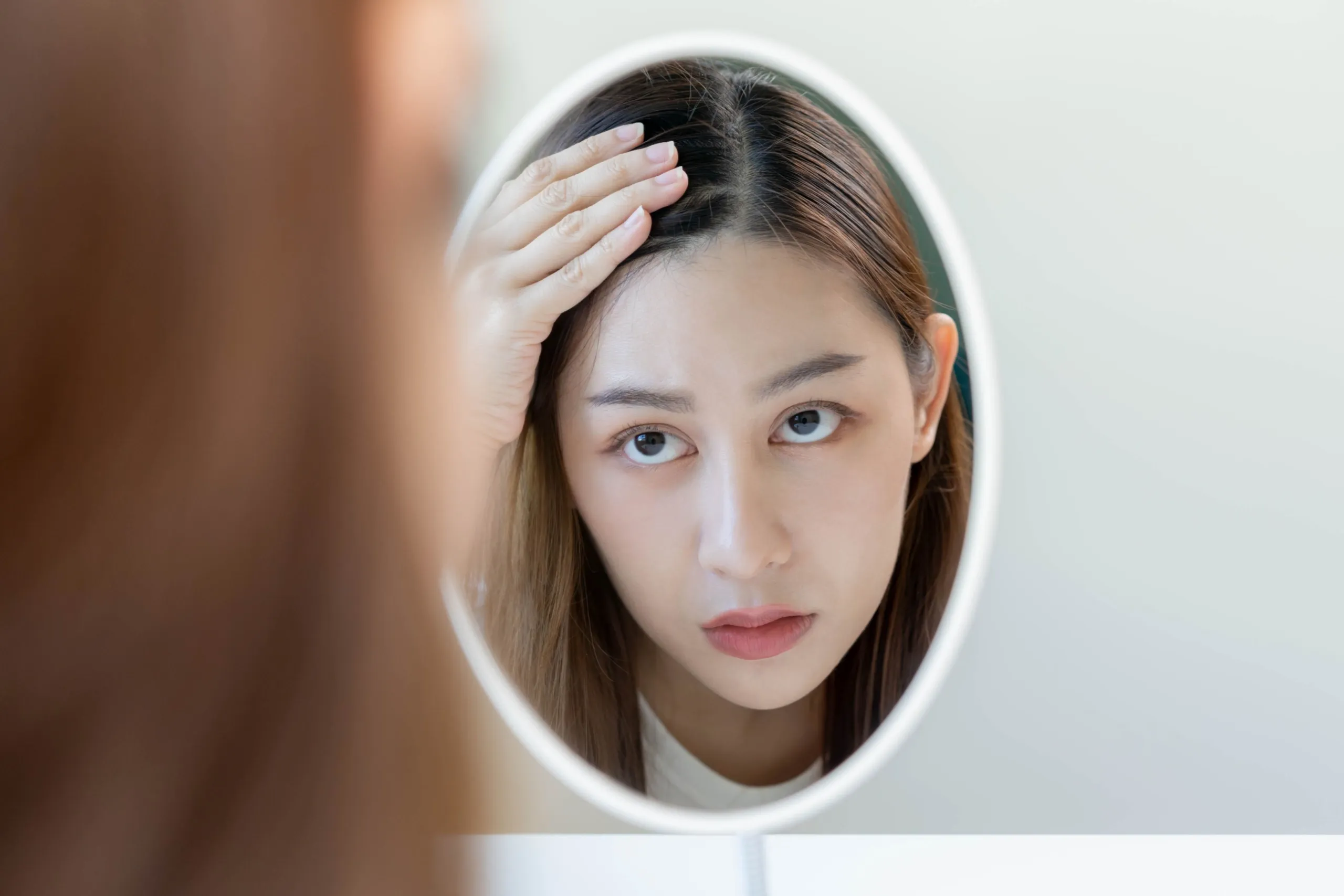 Hormonal Alopecia: Causes, Signs, and Proven Ways to Fight Back