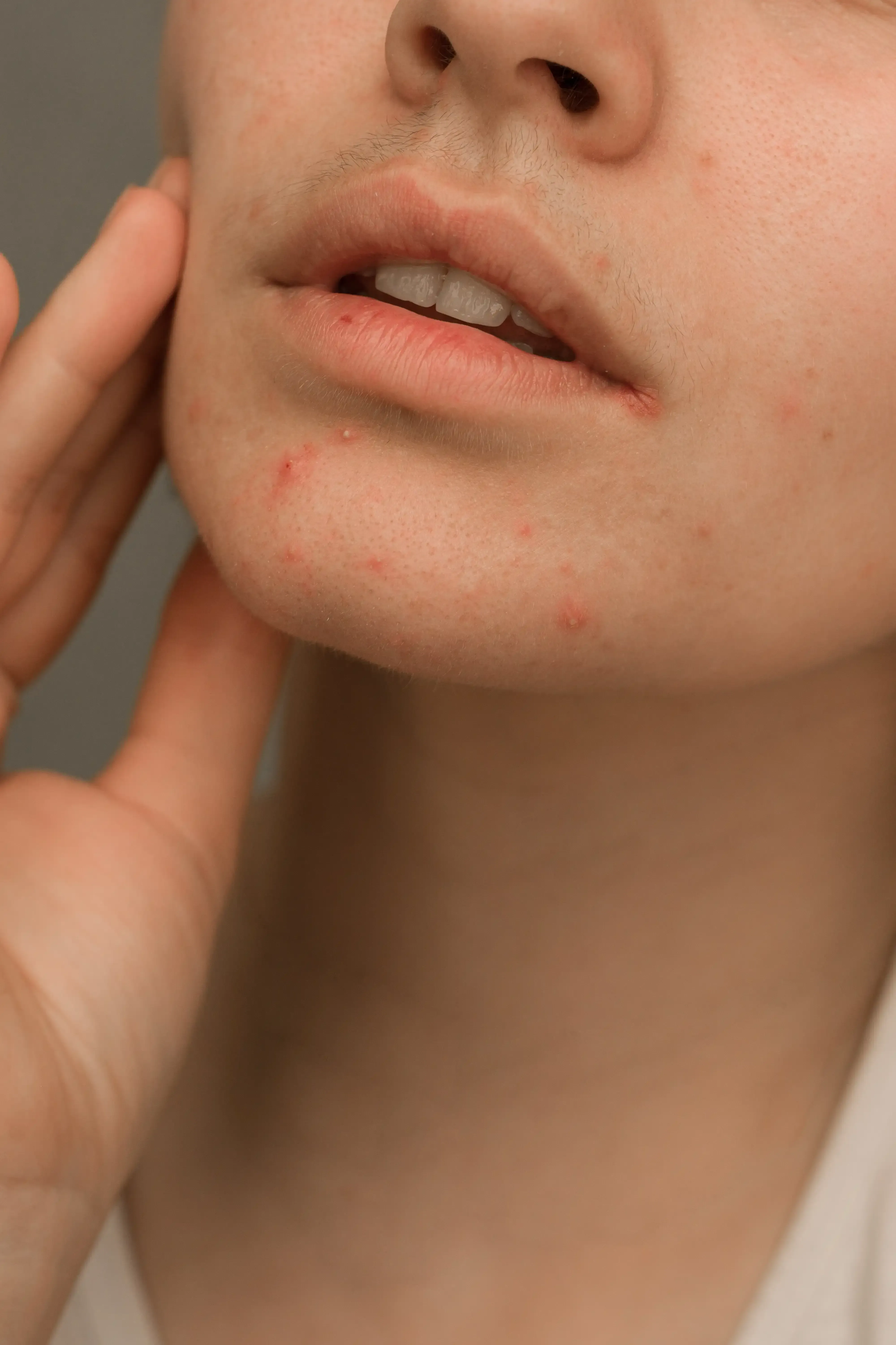 Understanding hormone imbalance symptoms at Arise Integrative Wellness