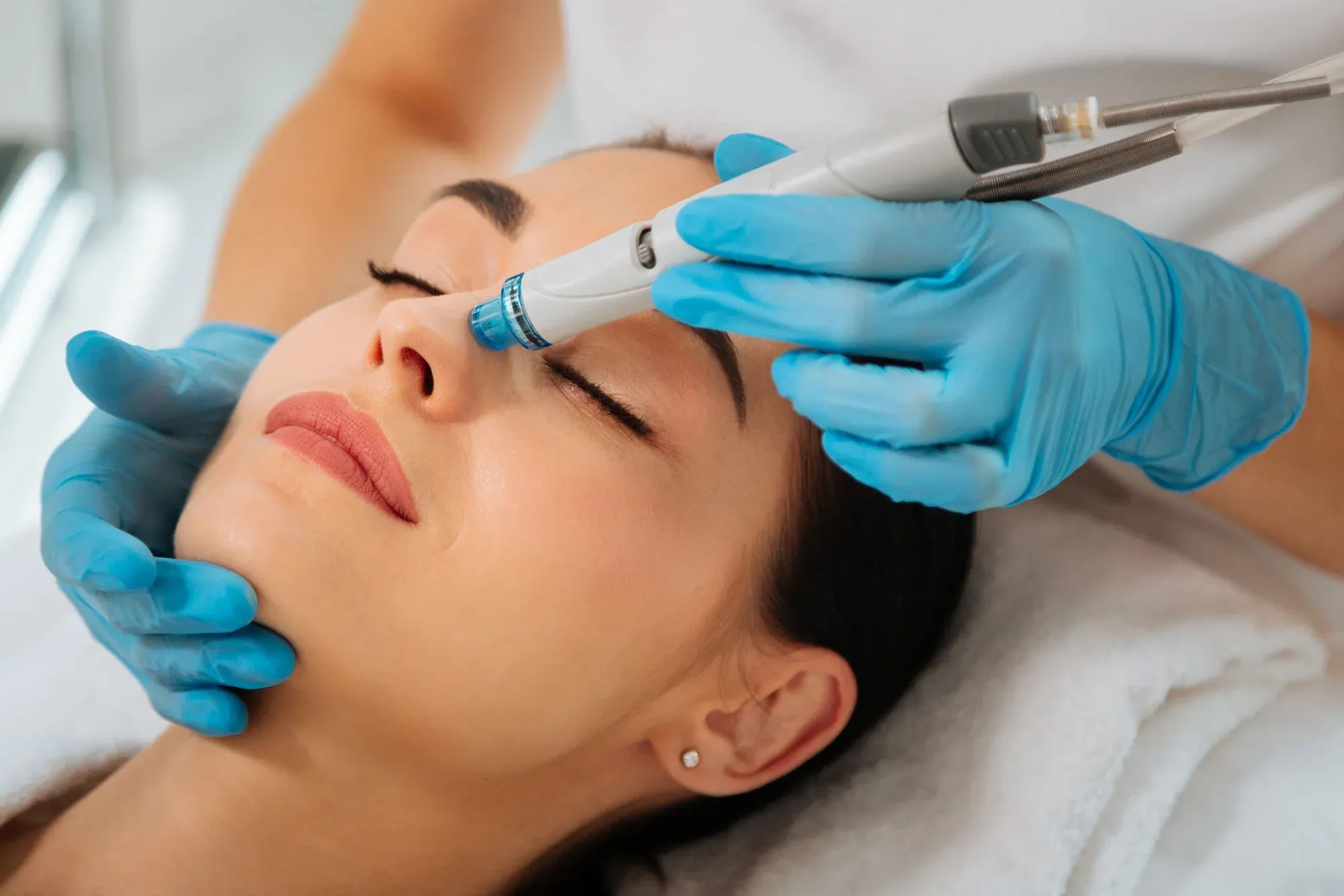 HydraFacial treatment at Radiant Laser MD in Cambridge, MA