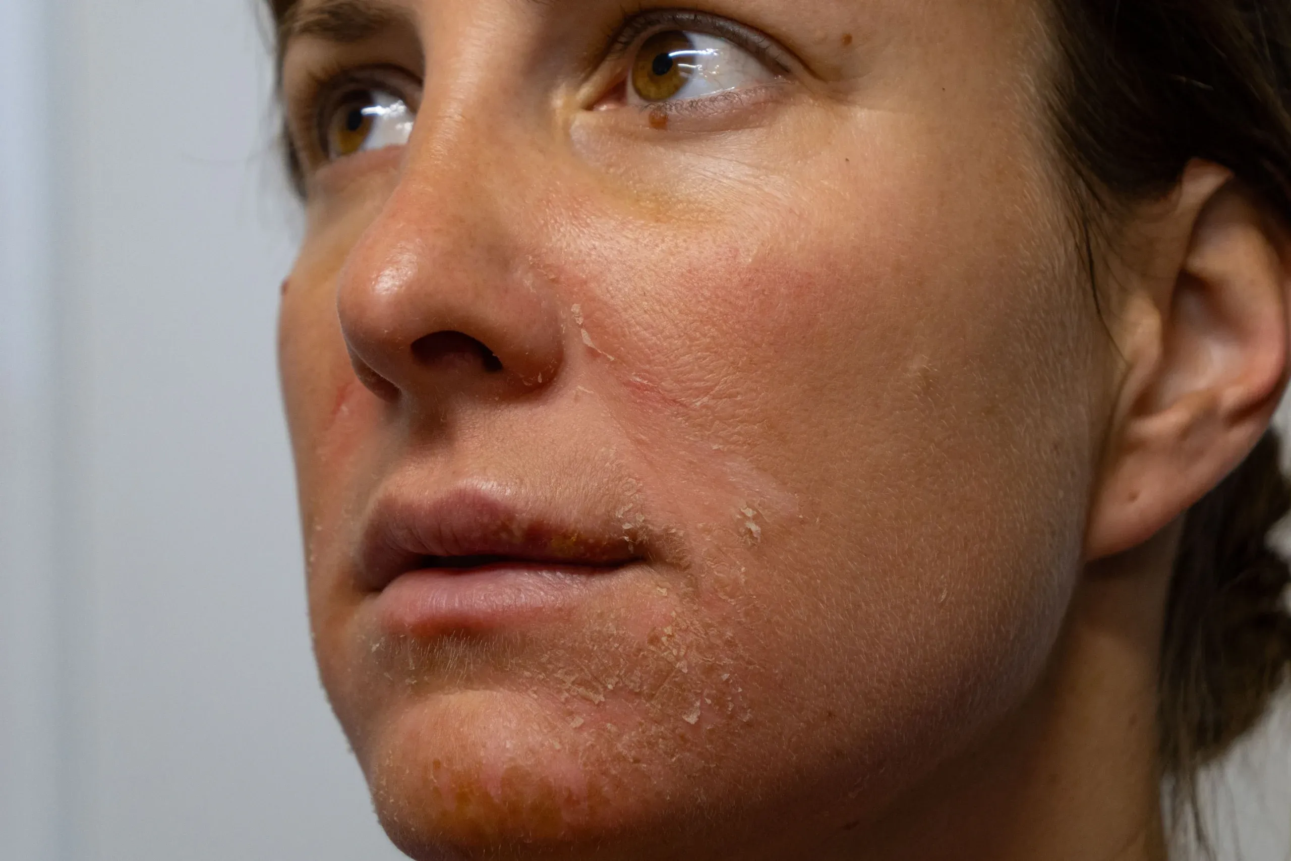 Woman with bright even complexion after hyperpigmentation treatment at Eternal Wellness Medical Spa in Traverse City MI
