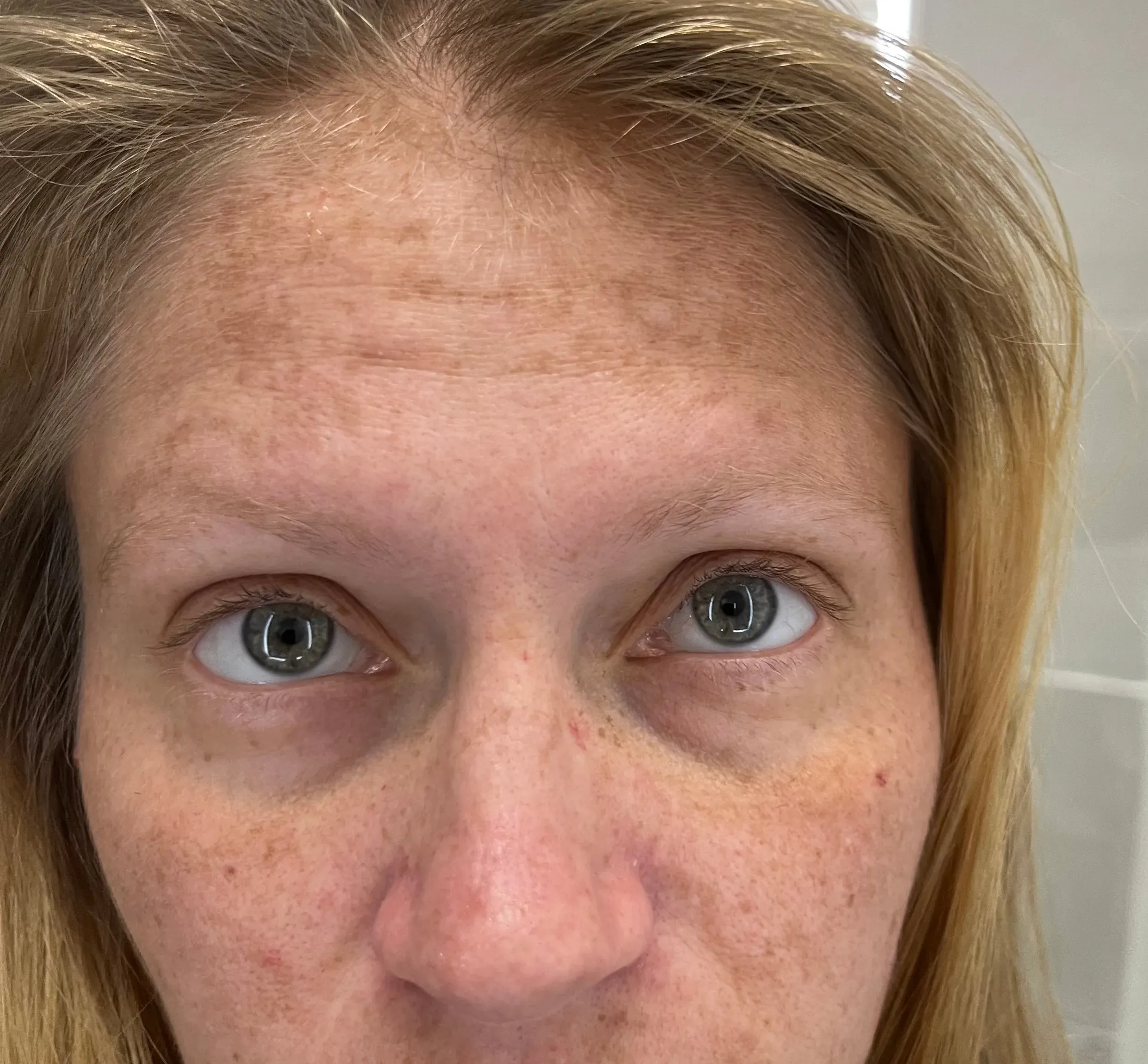 Diagram showing melanin pathways and pigment regulation at Eternal Wellness Medical Spa Traverse City