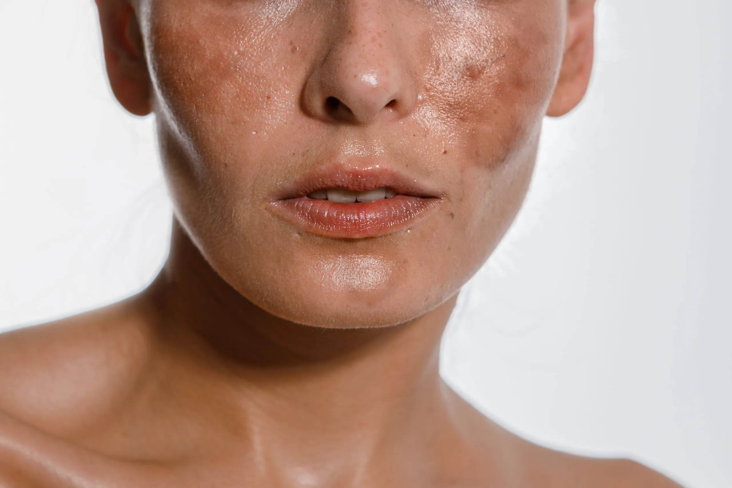 Woman with clear even skin after laser sunspot treatment at Eternal Wellness Medical Spa in Traverse City MI