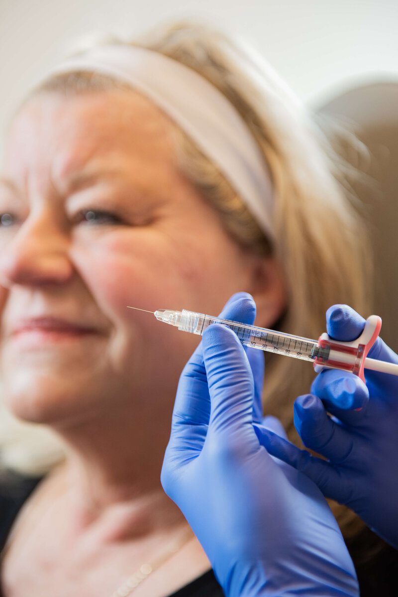 Before and after Juvederm results showing facial rejuvenation at Eternal Wellness Traverse City