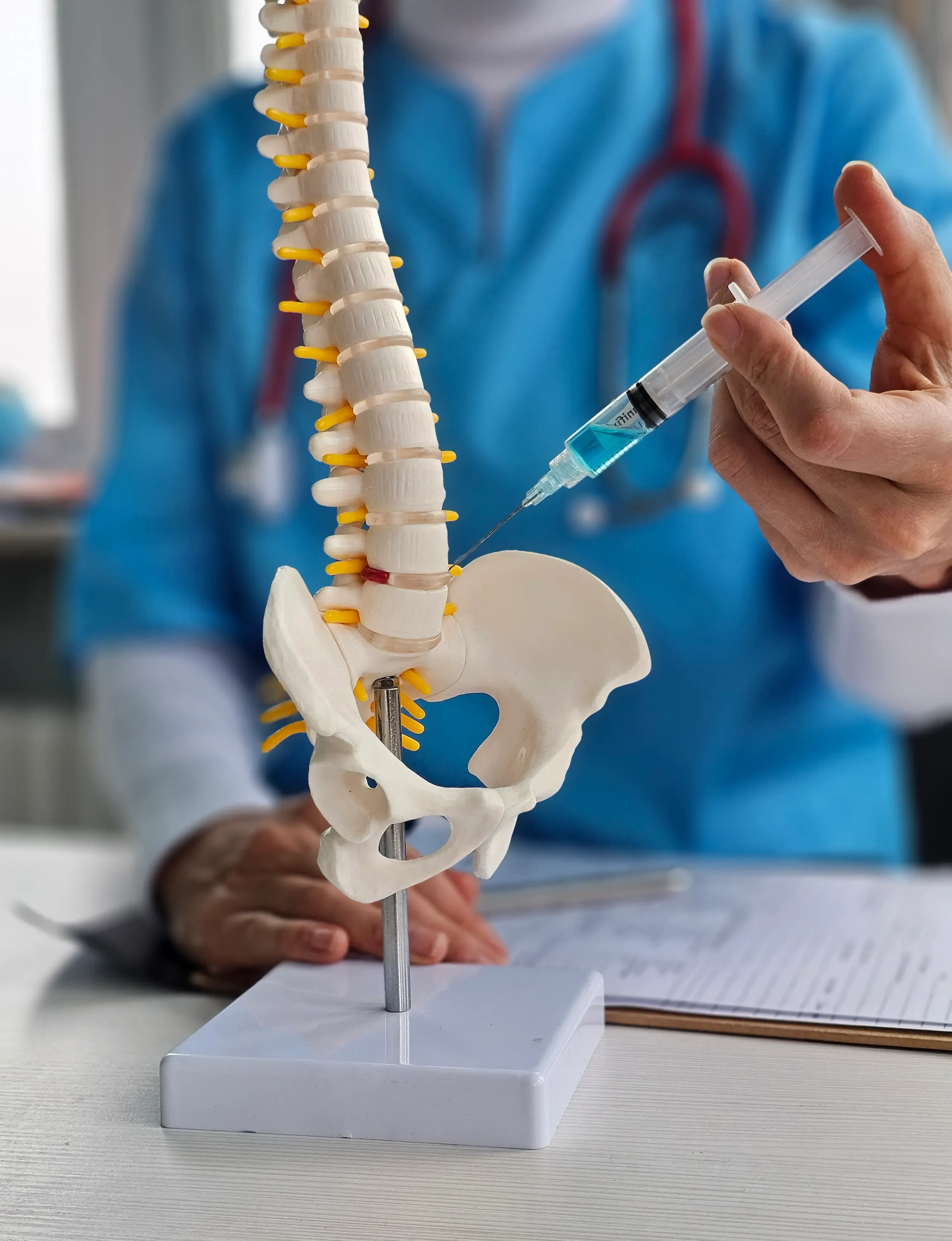 Before and after illustration showing sacroiliac joint inflammation and treatment improvement
