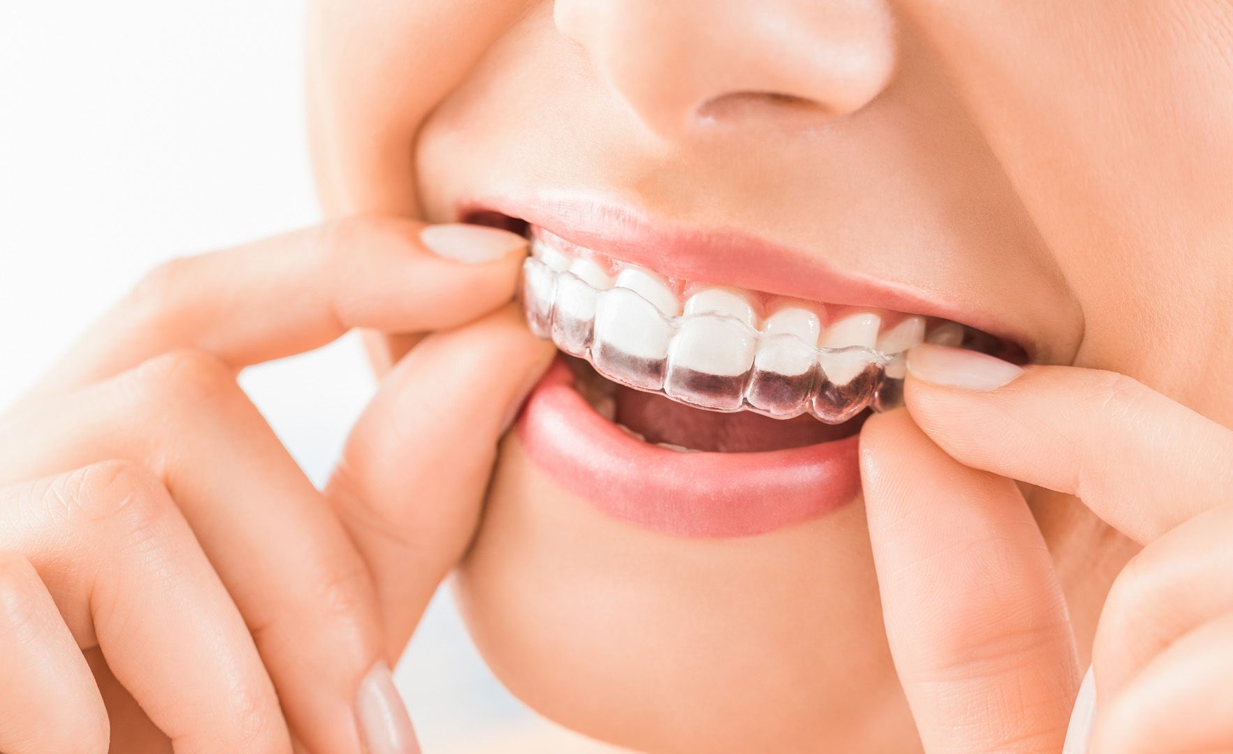 Adult patient holding a clear Invisalign aligner tray at Cook Family Dentistry in Santa Rosa Beach