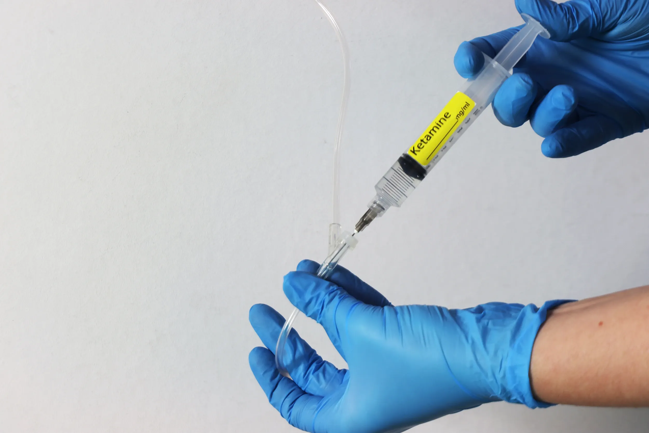 The Science Behind Ketamine as a Therapeutic Agent