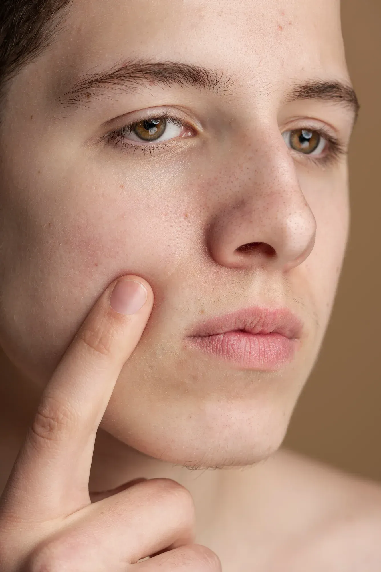 Illustration of enlarged pores and collagen loss at Resurgent Health Fargo