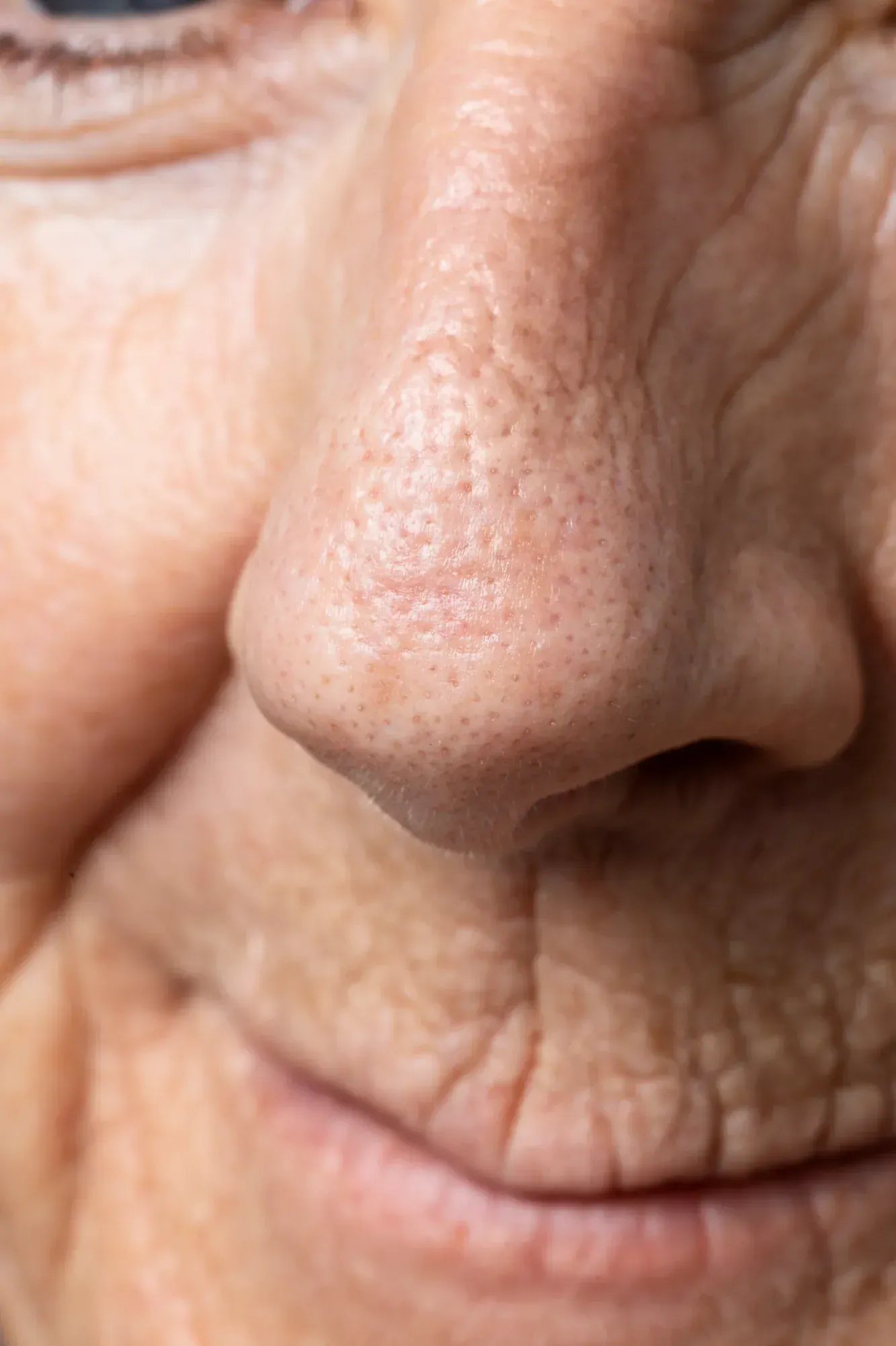 Diagram of pore structure and collagen support at Resurgent Health Fargo