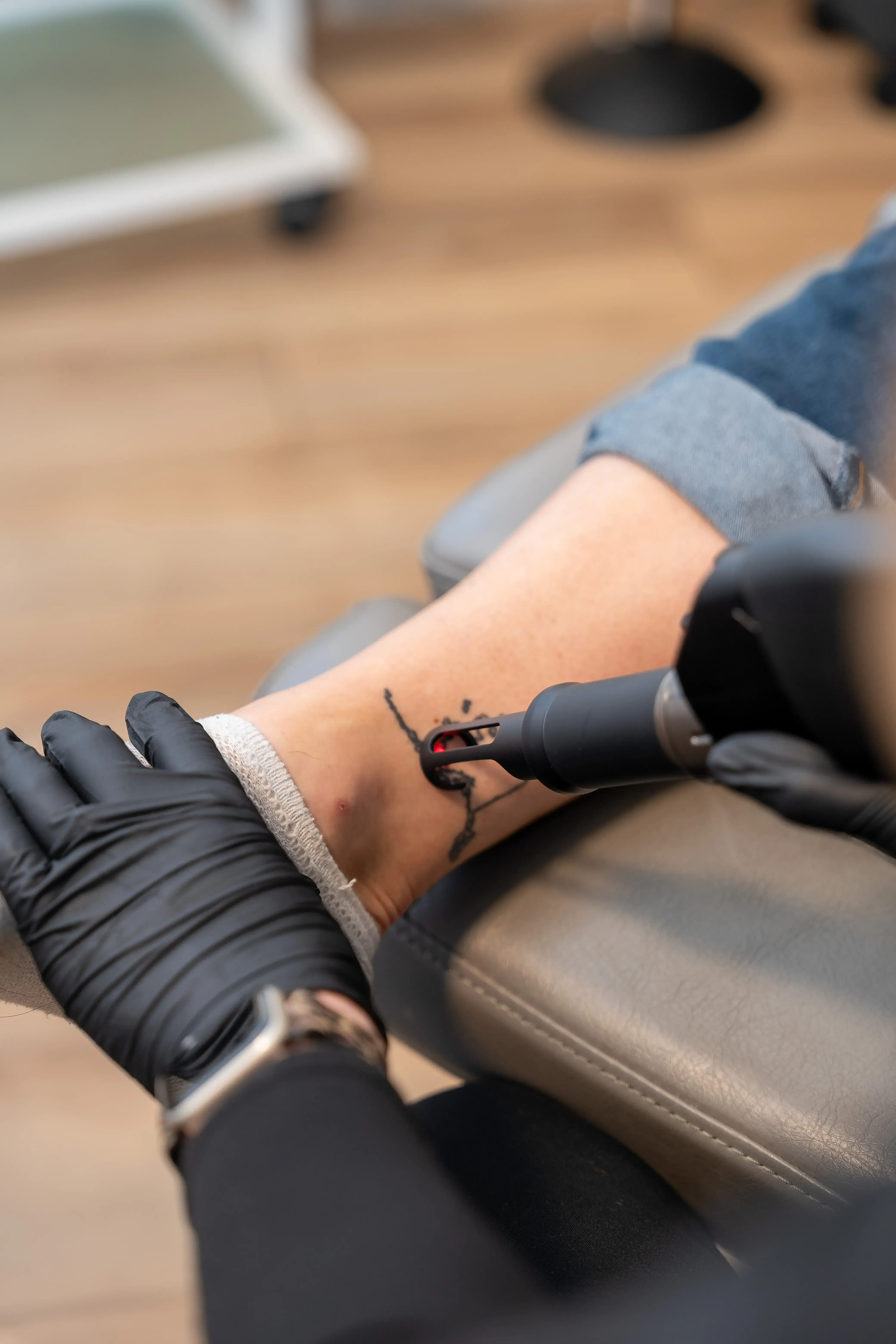 Patient consultation for Deka TORO laser tattoo removal at Eternal Wellness Medical Spa in Traverse City