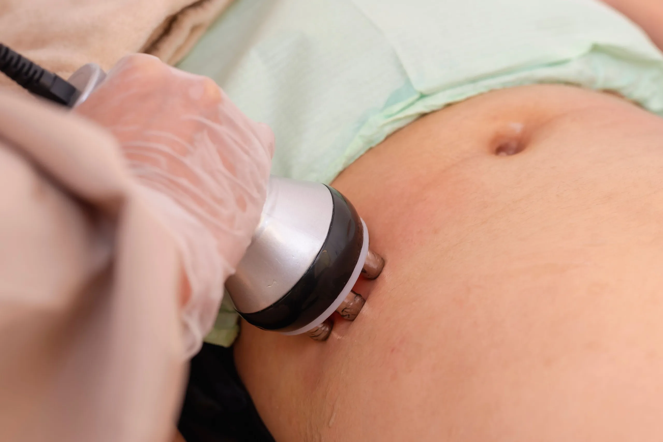 Patient consultation for LightForce laser therapy benefits at Arise Integrative Wellness Port Charlotte