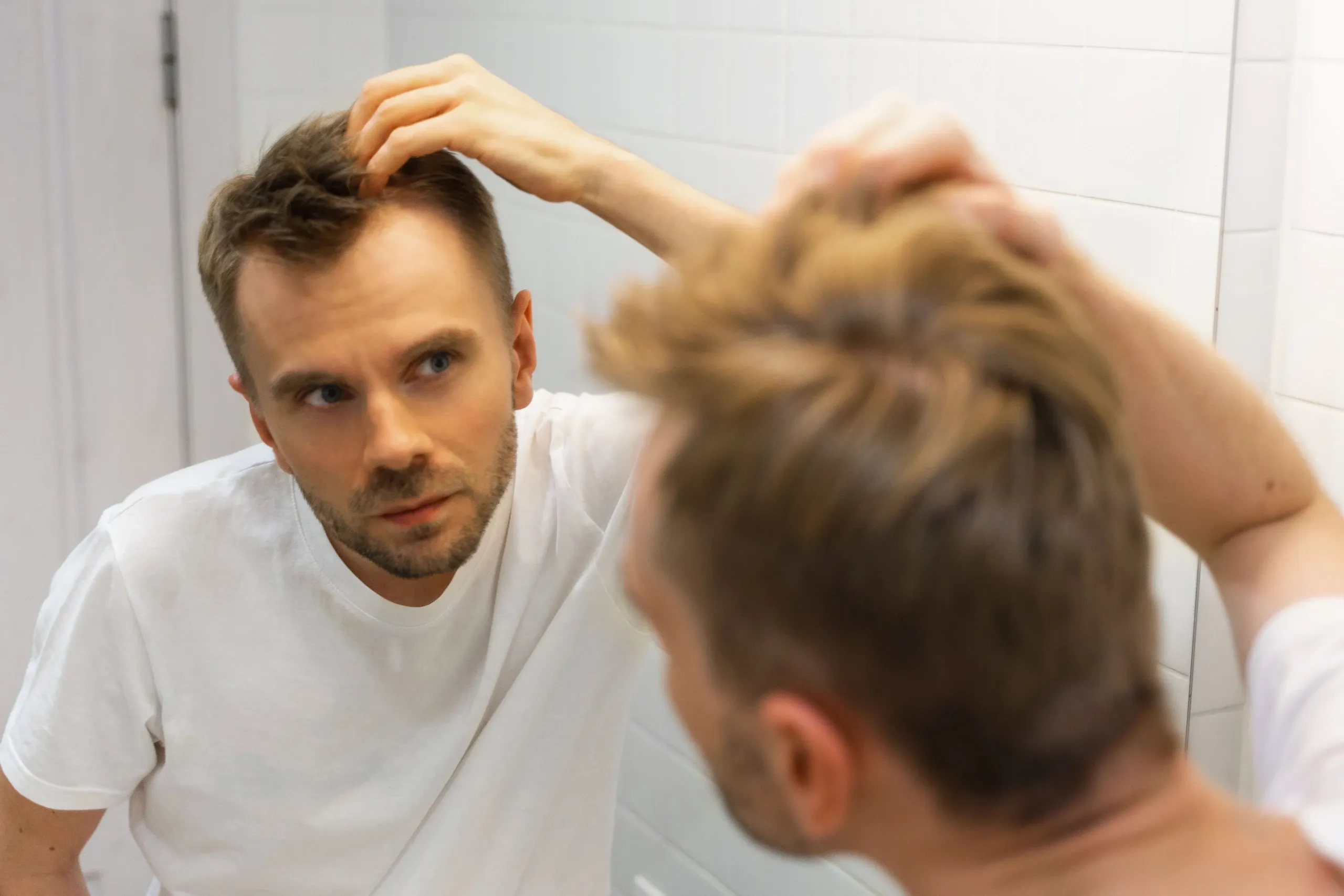 A Doctor's Deep Dive into Male Pattern Baldness