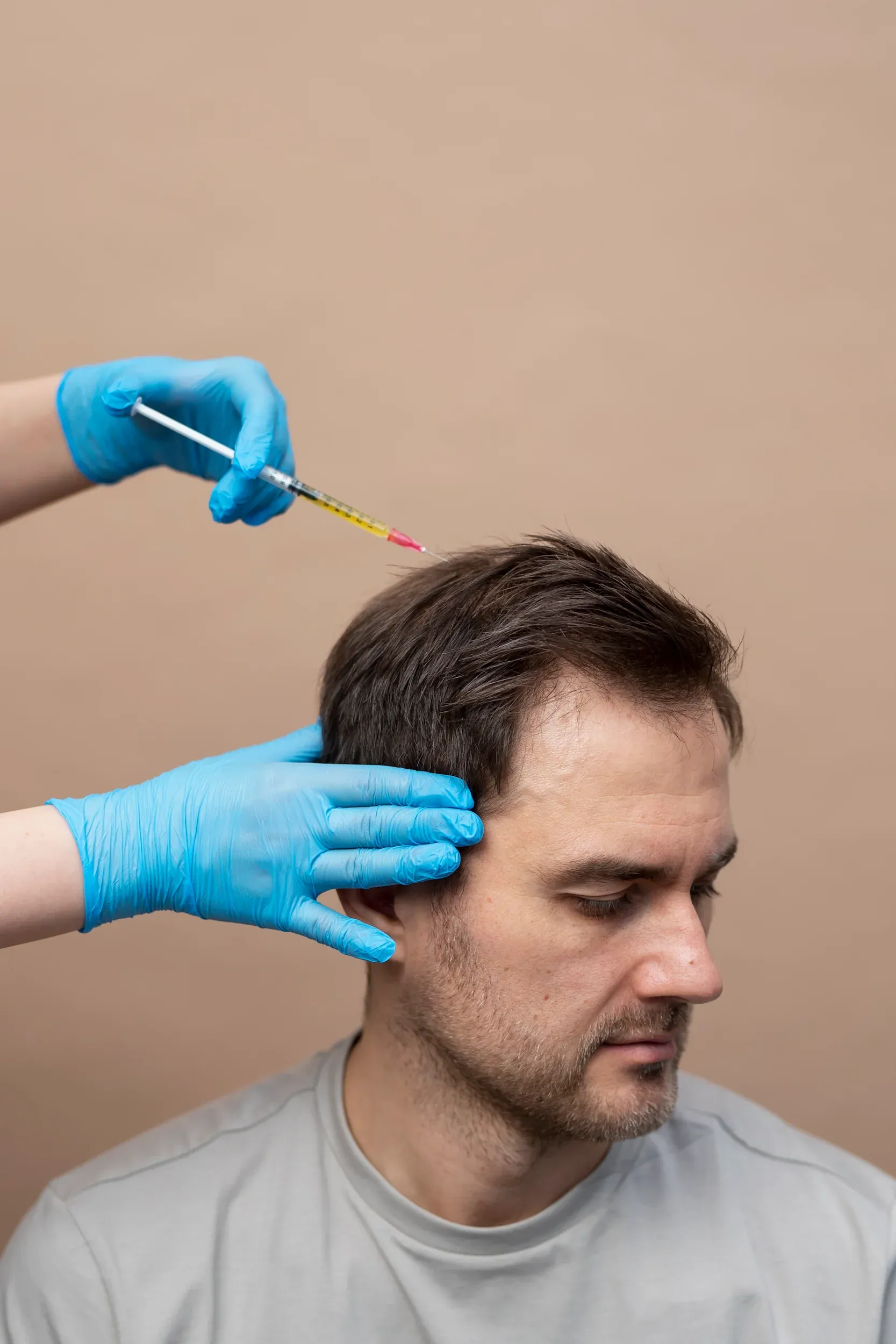 Patient consulting with Dr. Khanna about PRP hair restoration benefits