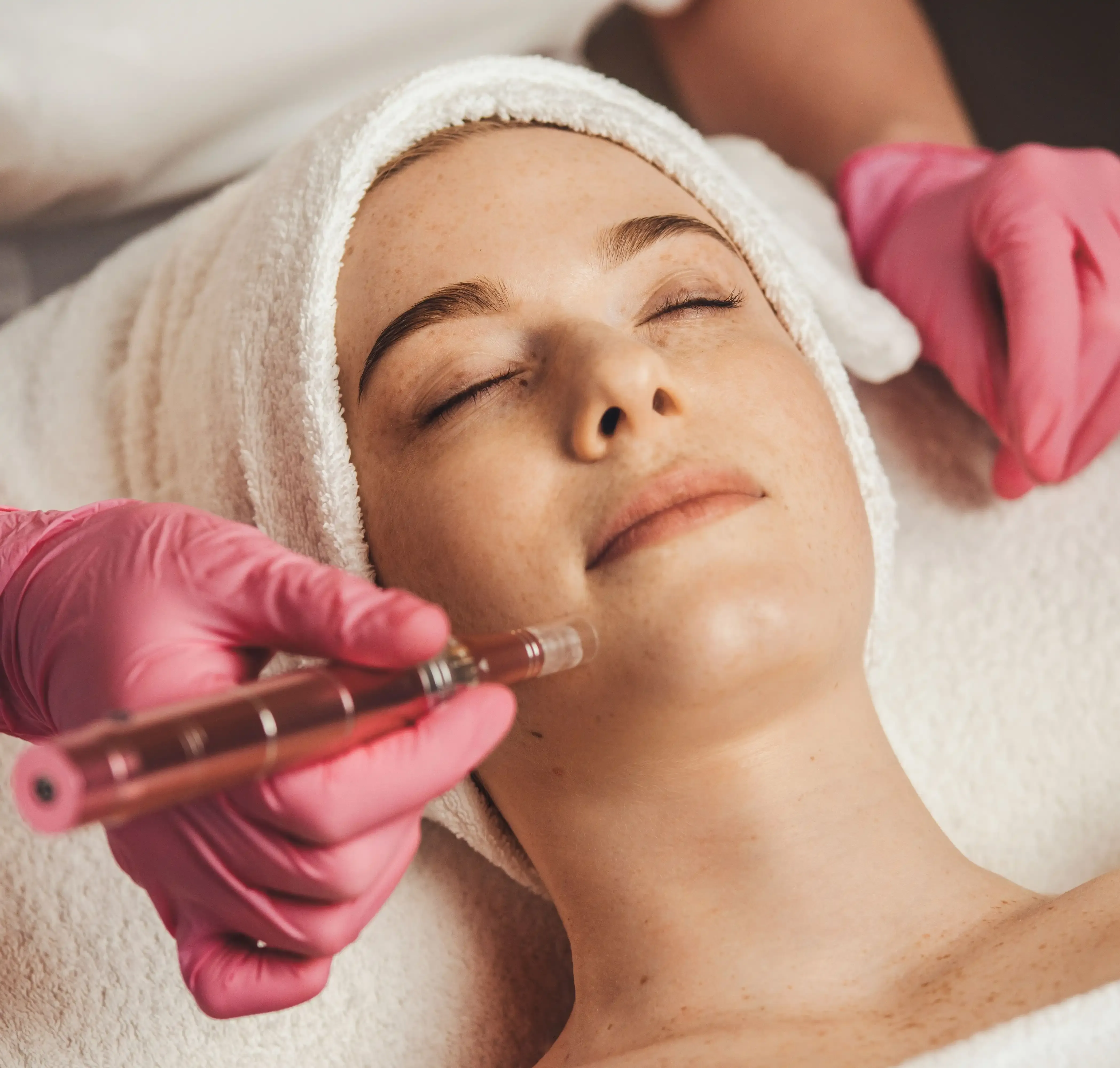 Microneedling device used at Mint Aesthetics & Skin Indianapolis