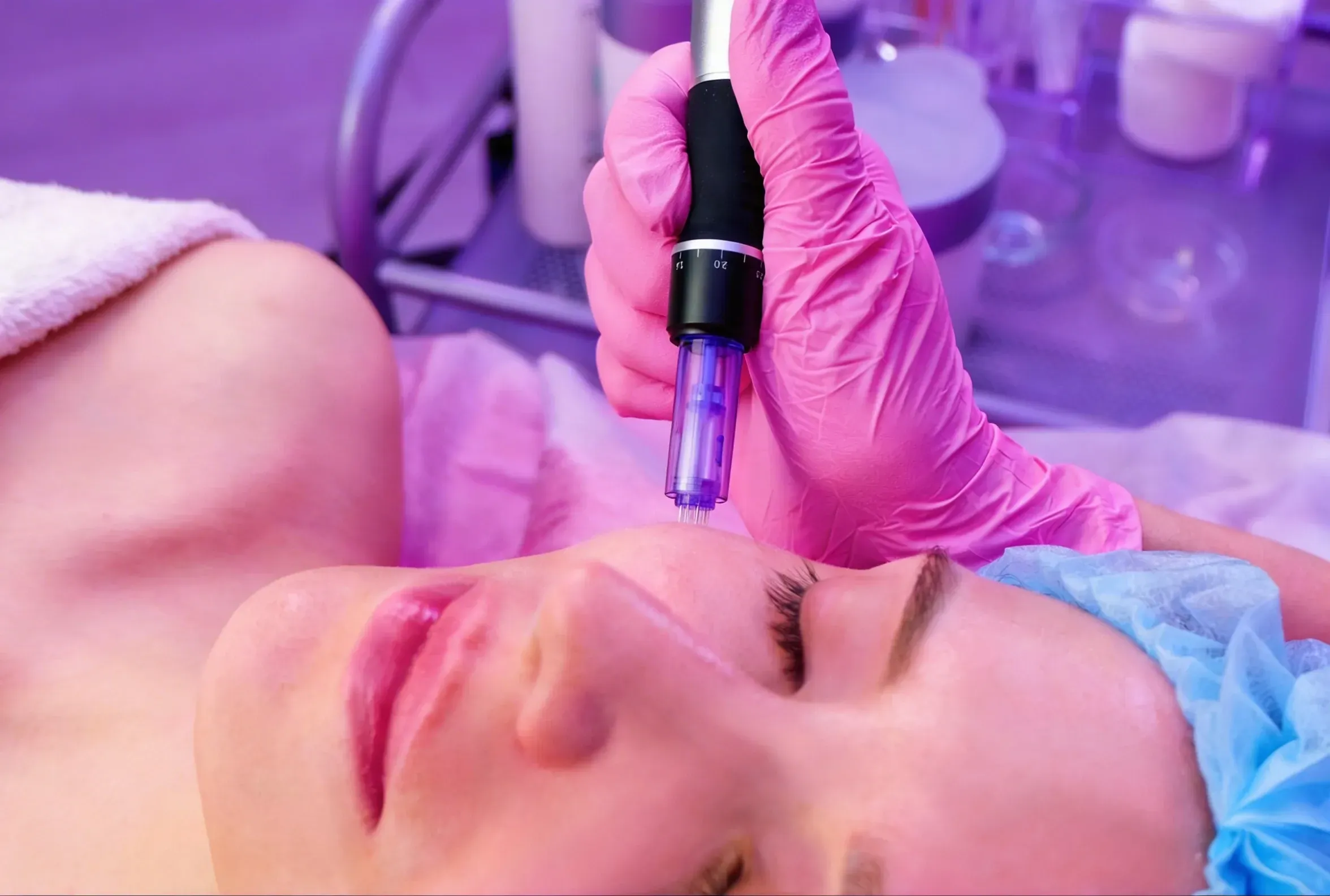 Safety and clinical information for microneedling at Mint Aesthetics Indianapolis