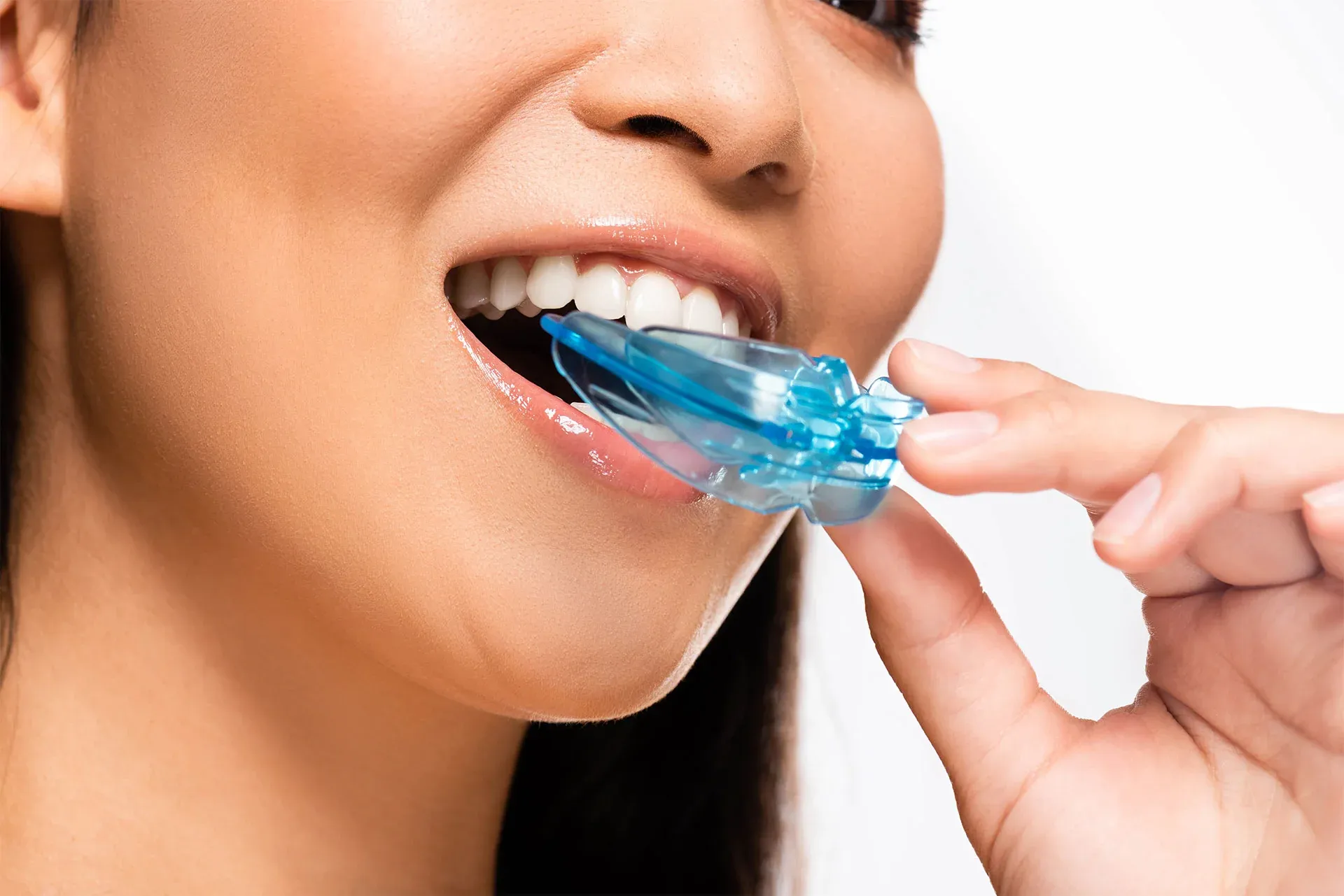 Custom mouth guard from Cook Family Dentistry in Santa Rosa Beach