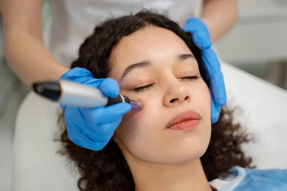 Does microneedling hurt treatment with SkinStylus at Radiant Laser MD in Cambridge MA