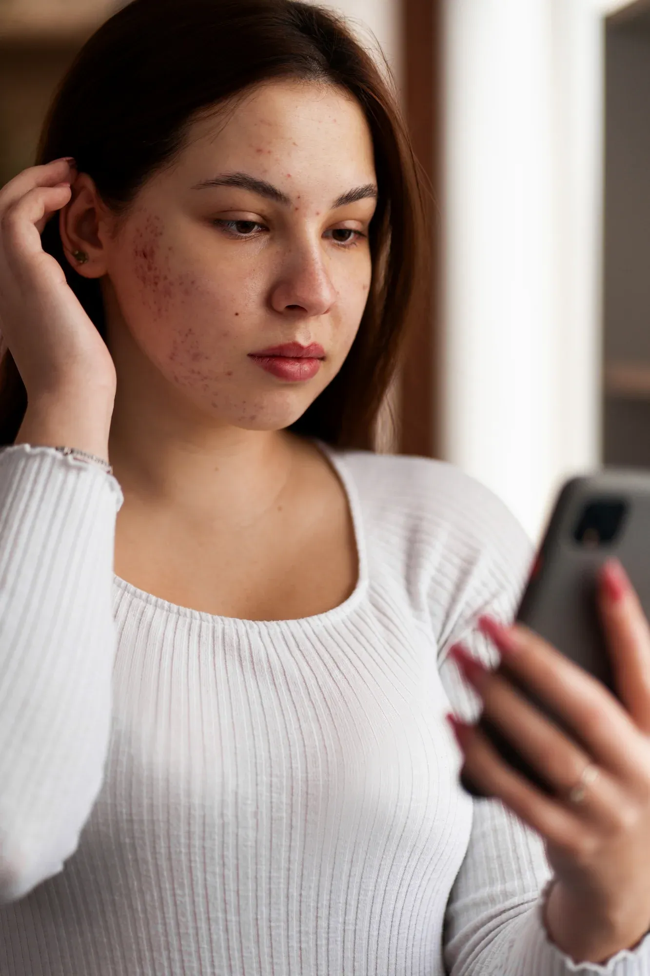 Person concerned about acne and scarring at Mint Aesthetics & Skin