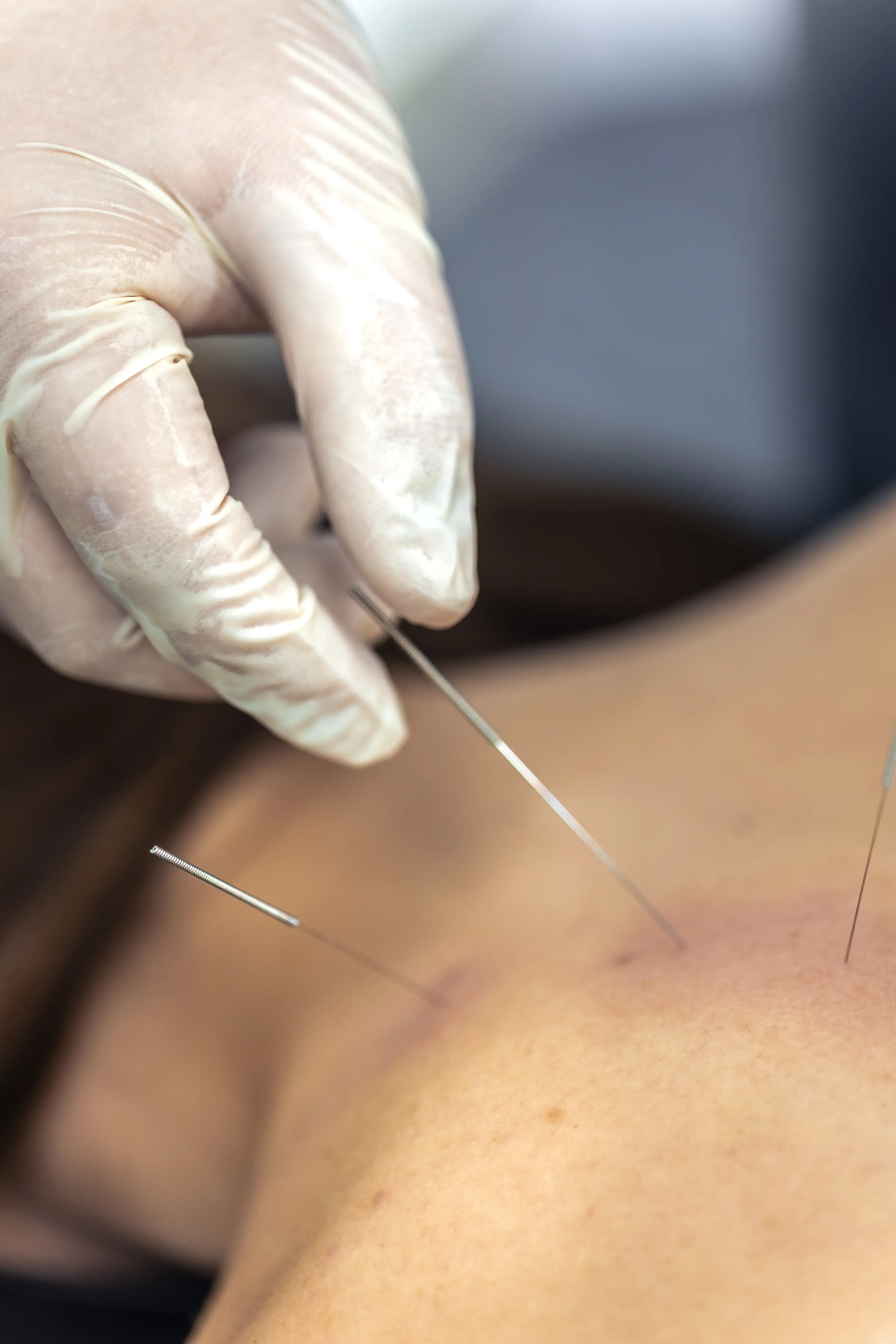 Electrodiagnostic testing equipment and nerve conduction study setup at PTCOFMD