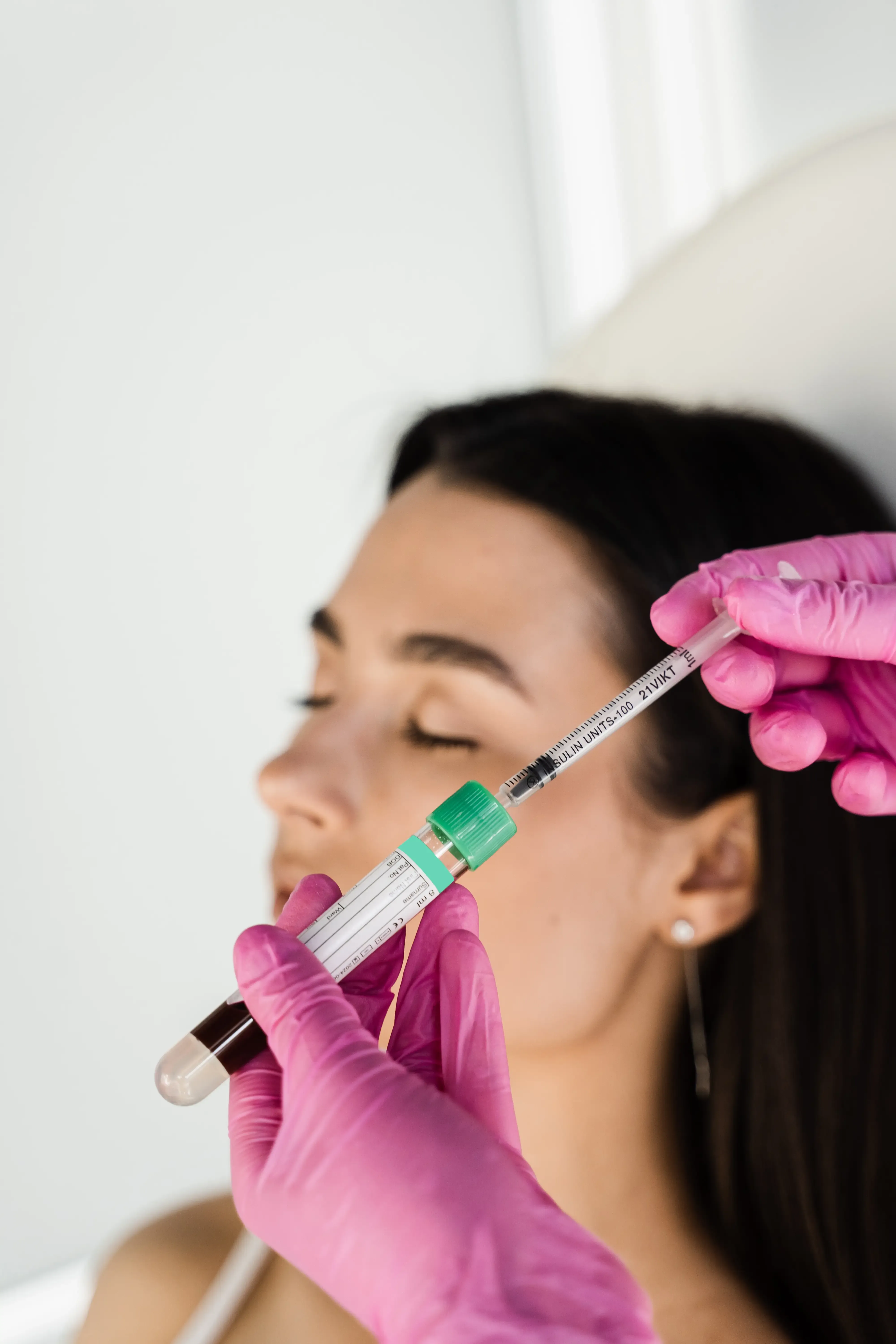 Before and after Dysport treatment results at RegalMed Clinic Fort Myers