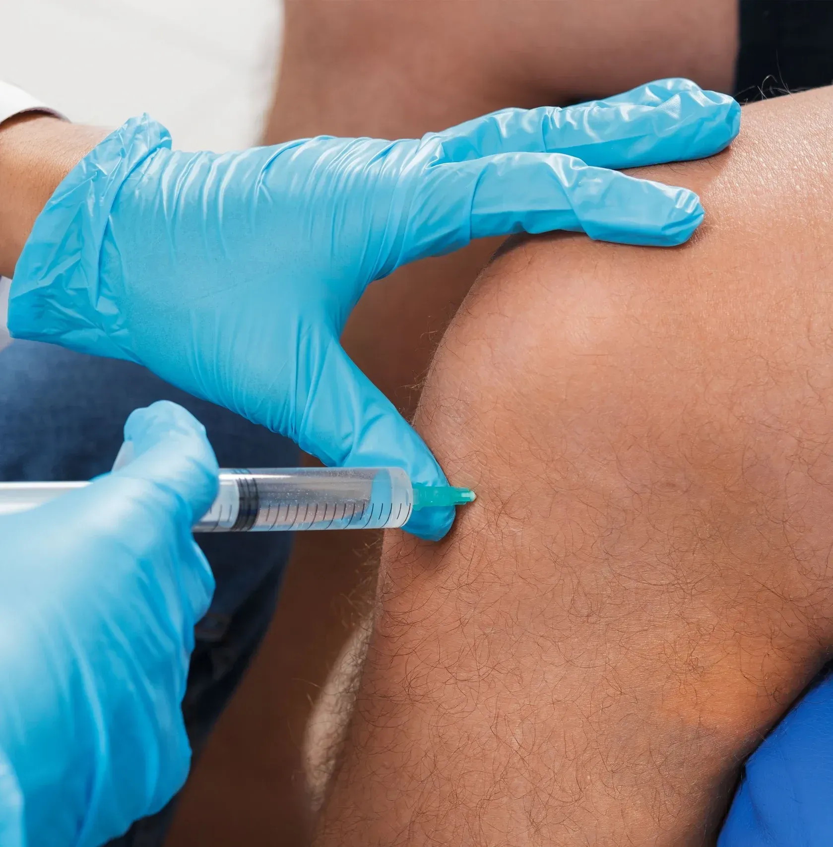 Where PRP Injections Fit in Your Care Plan