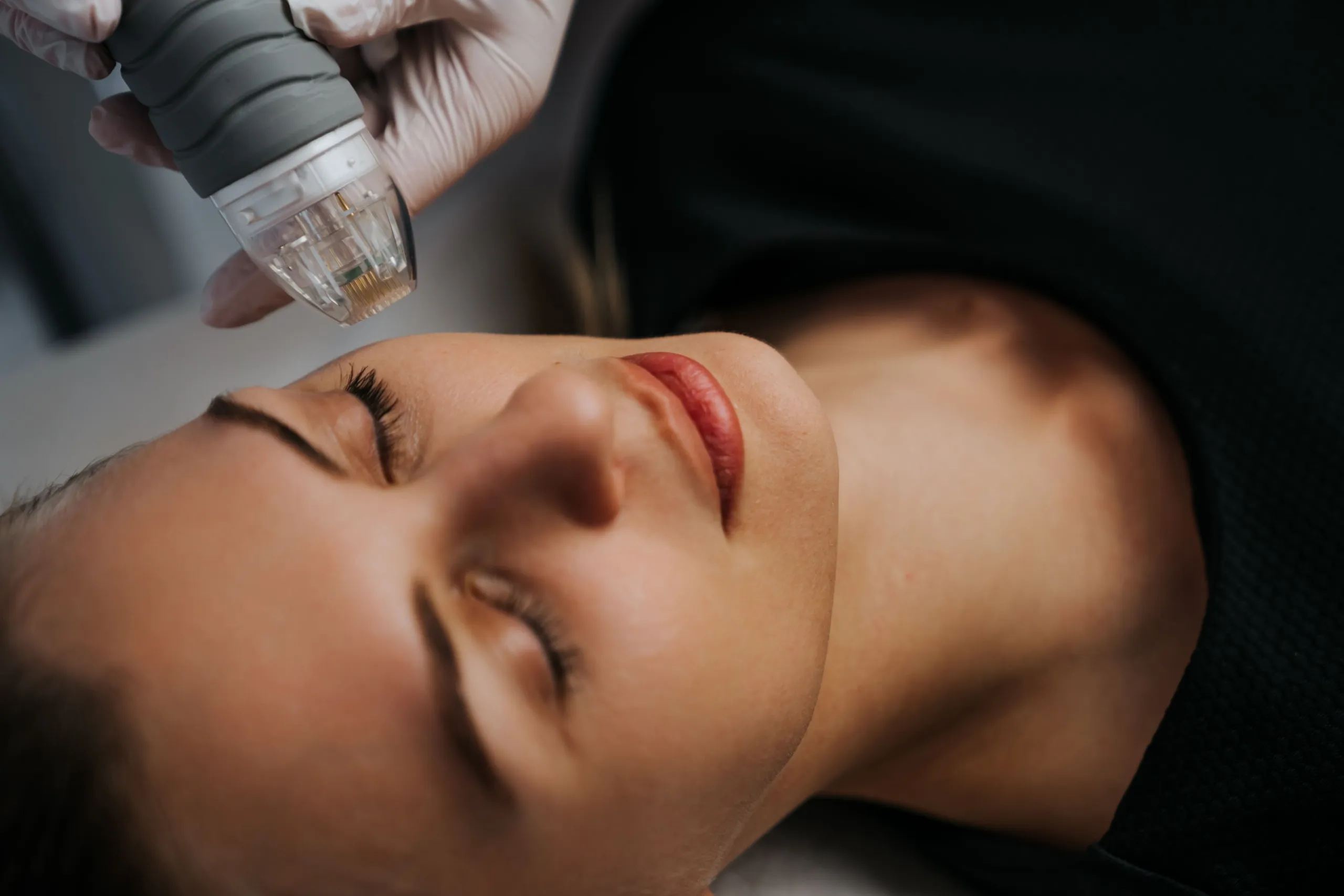 Abstract skin tightening background for RF microneedling concerns