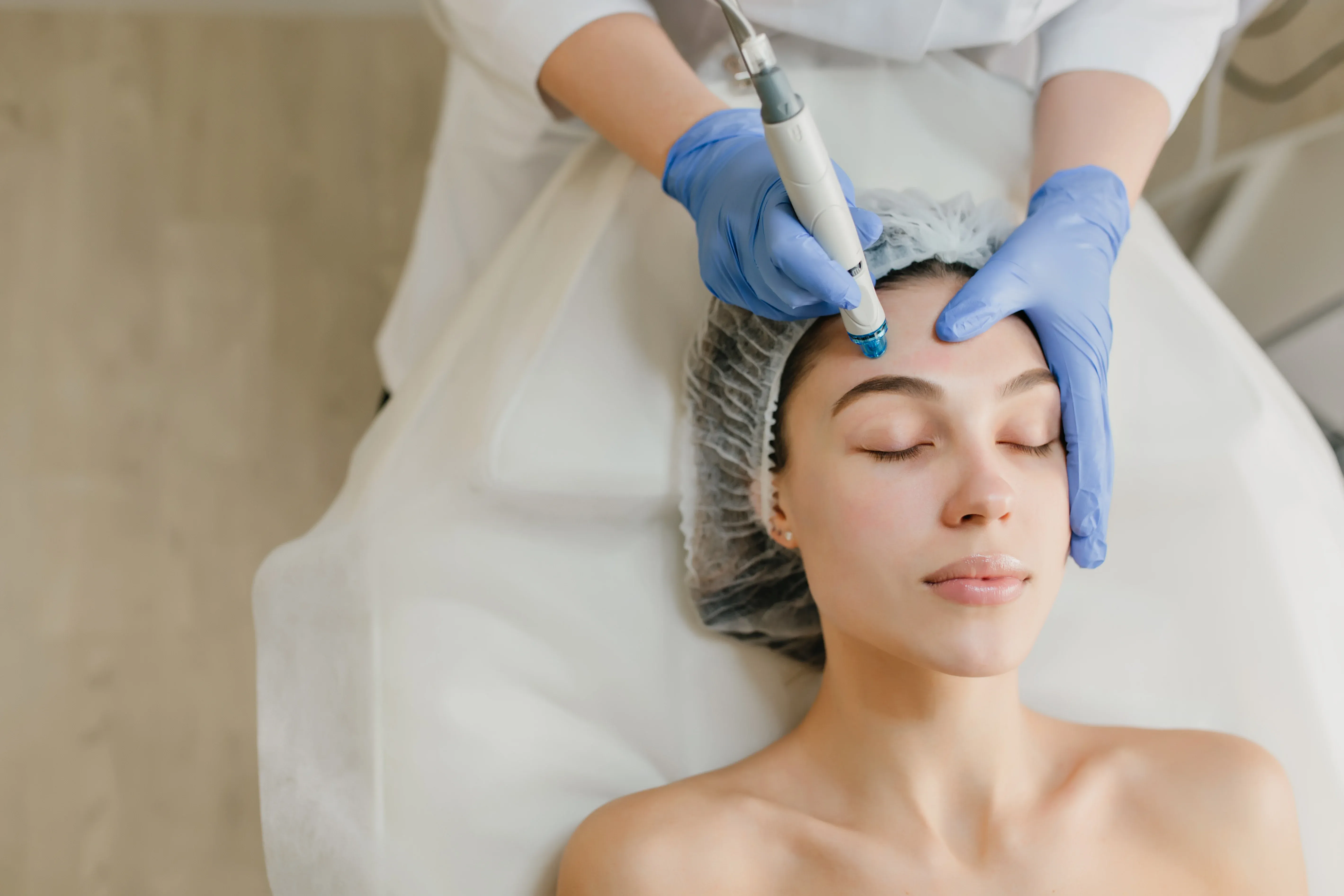 RF Microneedling safety protocols